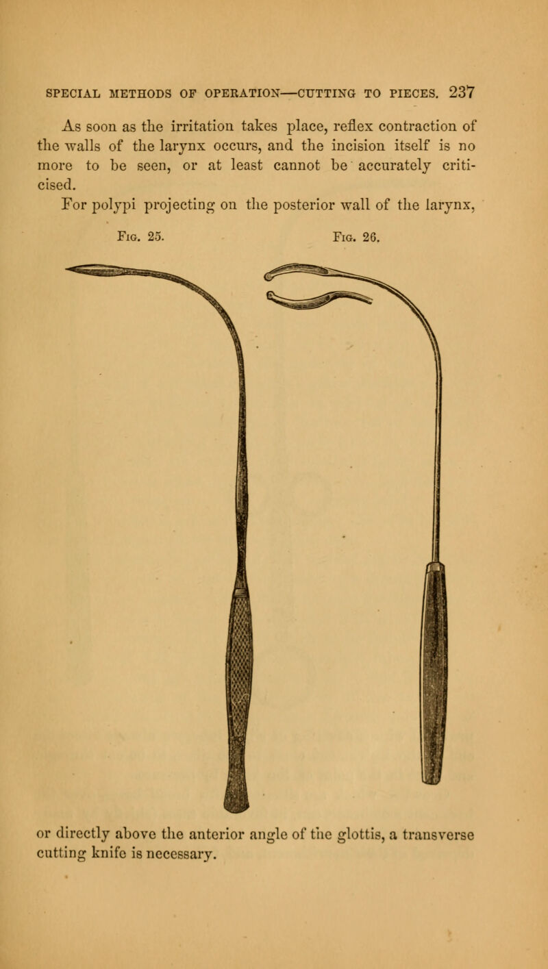 As soon as the irritation takes place, reflex contraction of the walls of the larynx occurs, and the incision itself is no more to be seen, or at least cannot be accurately criti- cised. For polypi projecting on the posterior wall of the larynx, Fig. 25. Fig. 26. or directly above the anterior angle of the glottis, a transverse cutting knife is necessary.