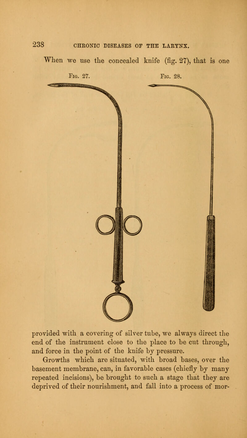 When we use the concealed knife (fig. 27), that is one Fig. 27. Fig. 28. provided with a covering of silver tube, we always direct the end of the instrument close to the place to be cut through, and force in the point of the knife by pressure. Growths which are situated, with broad bases, over the basement membrane, can, in favorable cases (chiefly by many repeated incisions), be brought to such a stage that they are deprived of their nourishment, and fall into a process of mor-