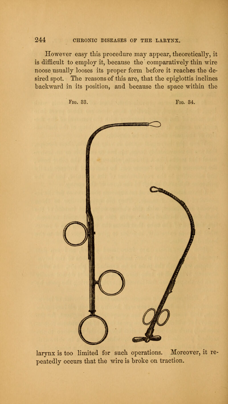 However easy this procedure may appear, theoretically, it is difficult to employ it, because the comparatively thin wire noose usually looses its proper form before it reaches the de- sired spot. The reasons of this are, that the epiglottis inclines backward in its position, and because the space within the Fig. 33. Fig. 34. larynx is too limited for such operations. Moreover, it re peatedly occurs that the wire is broke on traction.
