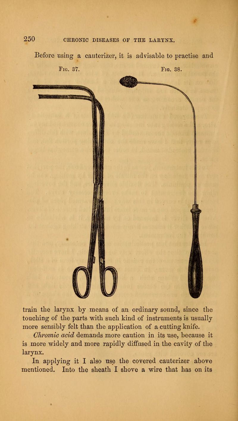 Before using a cauterizer, it is advisable to practise and Fig. 37. Fig. 38. train the larynx by means of an ordinary sound, since the touching of the parts with such kind of instruments is usually more sensibly felt than the application of a cutting knife. Chromic acid demands more caution in its use, because it is more widely and more rapidly diffused in the cavity of the larynx. In applying it I also use the covered cauterizer above mentioned. Into the sheath I shove a wire that has on its