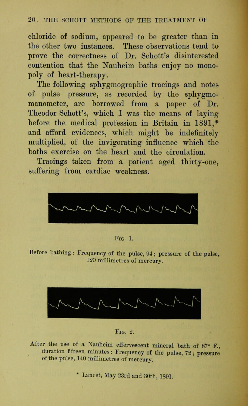 chloride of sodium, appeared to be greater than in the other two instances. These observations tend to prove the correctness of Dr. Schott's disinterested contention that the Nauheim baths enjoy no mono- poly of heart-therapy. The following sphygmographic tracings and notes of pulse pressure, as recorded by the sphygmo- manometer, are borrowed from a paper of Dr. Theodor Schott's, which I was the means of laying before the medical profession in Britain in 1891,* and afford evidences, which might be indefinitely multiplied, of the invigorating influence which the baths exercise on the heart and the circulation. Tracings taken from a patient aged thirty-one, suffering from cardiac weakness. Fig. 1. Before bathing: Frequency of the pulse, 94; pressure of the pulse, 120 millimetres of mercury. Fig. 2. After the use of a Nauheim effervescent mineral bath of 87° F., duration fifteen minutes: Frequency of the pulse, 72; pressure of the pulse, 140 millimetres of mercury. * Lancet, May 23rd and 30th, 1891.