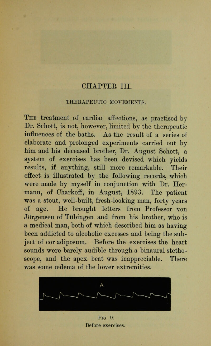 CHAPTER III. THERAPEUTIC MOVEMENTS. The treatment of cardiac affections, as practised by Dr. Schott, is not, however, limited by the therapeutic influences of the baths. As the result of a series of elaborate and prolonged experiments carried out by him and his deceased brother, Dr. August Schott, a system of exercises has been devised which yields results, if anything, still more remarkable. Their effect is illustrated by the following records, which were made by myself in conjunction with Dr. Her- mann, of Charkoff, in August, 1893. The patient was a stout, well-built, fresh-looking man, forty years of age. He brought letters from Professor von Jorgensen of Tiibingen and from his brother, who is a medical man, both of which described him as having been addicted to alcoholic excesses and being the sub- ject of cor adiposum. Before the exercises the heart sounds were barely audible through a binaural stetho- scope, and the apex beat was inappreciable. There was some oedema of the lower extremities. Fig. 9. Before exercises.