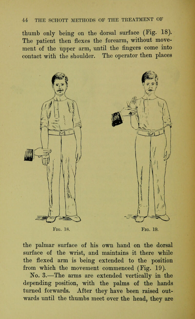 thumb only being on the dorsal surface (Fig. 18). The patient then flexes the forearm, without move- ment of the upper arm, until the fingers come into contact with the shoulder. The operator then places m\\ Fig. 18. Fig. 19. the palmar surface of his own hand on the dorsal surface of the wrist, and maintains it there while the flexed arm is being extended to the position from which the movement commenced (Fig. 19). No. 3.—The arms are extended vertically in the depending position, with the palms of the hands turned forwards. After they have been raised out- wards until the thumbs meet over the head, they are