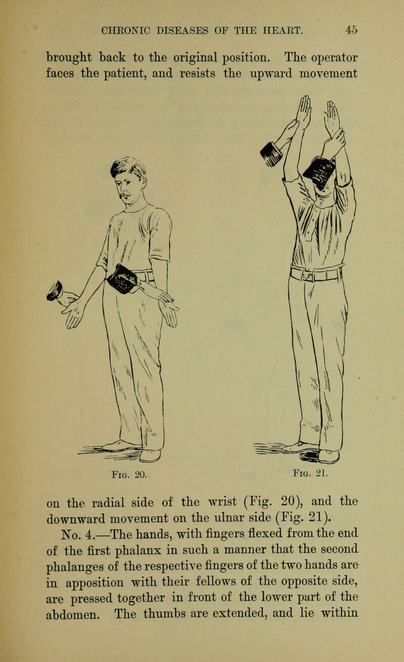 brought back to the original position. The operator faces the patient, and resists the upward movement Fig. 20. Fig. 21. on the radial side of the wrist (Fig. 20), and the downward movement on the ulnar side (Fig. 21). No. 4.—The hands, with fingers flexed from the end of the first phalanx in such a manner that the second phalanges of the respective fingers of the two hands are in apposition with their fellows of the opposite side, are pressed together in front of the lower part of the abdomen. The thumbs are extended, and lie within