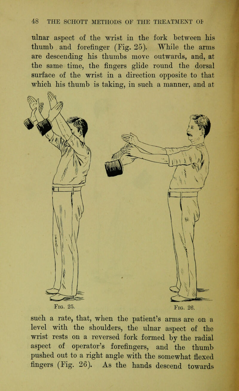 ulnar aspect of the wrist in the fork between his thumb and forefinger (Fig. 25). While the arms are descending his thumbs move outwards, and, at the same time, the fingers glide round the dorsal surface of the wrist in a direction opposite to that which his thumb is taking, in such a manner, and at Fig. 25. Fig. 26. such a rate, that, when the patient's arms are on a level with the shoulders, the ulnar aspect of the wrist rests on a reversed fork formed by the radial aspect of operator's forefingers, and the thumb pushed out to a right angle with the somewhat flexed fingers (Fig. 26). As the hands descend towards