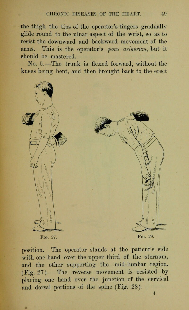 the thigh the tips of the operator's fingers gradually glide round to the ulnar aspect of the wrist, so as to resist the downward and backward movement of the arms. This is the operator's pons asinorum, but it should be mastered. No. 6.—The trunk is flexed forward, without the knees being bent, and then brought back to the erect Fig. 27. Fig. 28. position. The operator stands at the patient's side with one hand over the upper third of the sternum, and the other supporting the mid-lumbar region. (Fig. 27). The reverse movement is resisted by- placing one hand over the junction of the cervical and dorsal portions of the spine (Fig. 28). 4