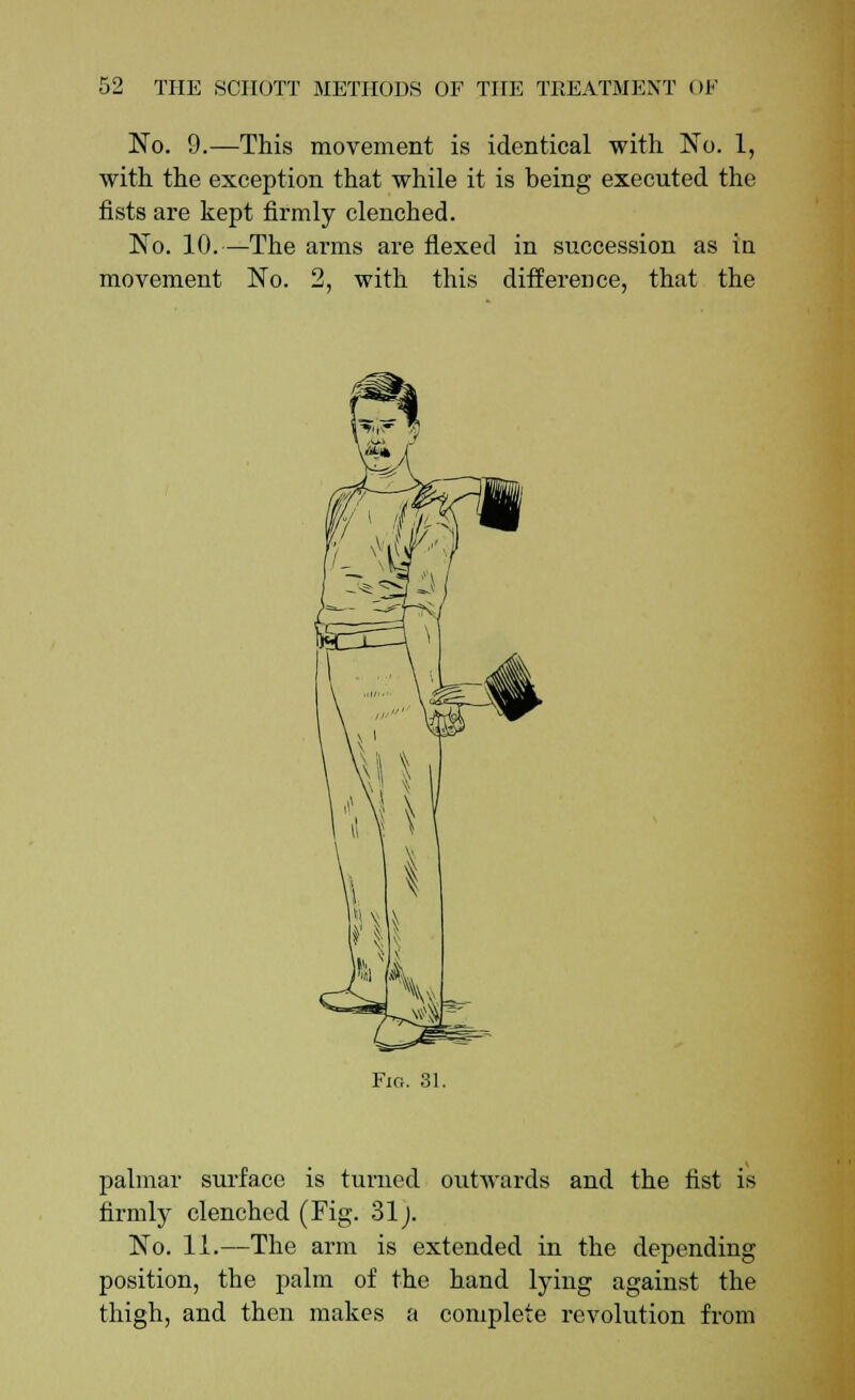 No. 9.—This movement is identical with No. 1, with the exception that while it is being executed the fists are kept firmly clenched. No. 10.—The arms are flexed in succession as in movement No. 2, with this difference, that the Fig. 31. palmar surface is turned outwards and the fist is firmly clenched (Fig. 31j. No. 11.—The arm is extended in the depending position, the palm of the hand lying against the thigh, and then makes a complete revolution from