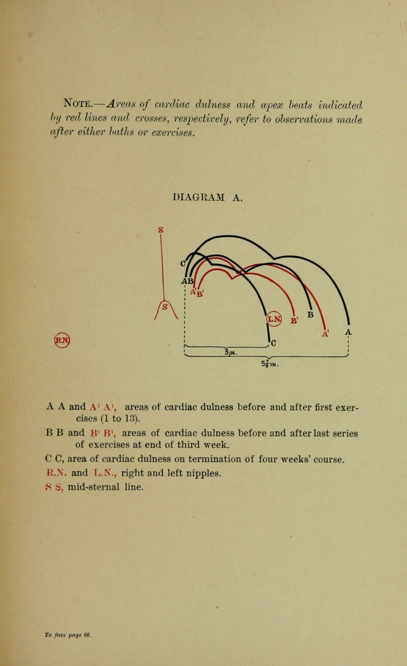 Note.—Areas of cwdiac dulness and apex beats indicated In/ red lines and crosses, respectively, refer to observations made after either baths or exercises. DIAGRAM A. 5s-in. A A and A1 A', areas of cardiac dulness before and after first exer- cises (1 to 13). B B and I!1 IV, areas of cardiac dulness before and after last series of exercises at end of third week. C C, area of cardiac dulness on termination of four weeks' course. R.N. and L.N., right and left nipples. S S, mid-sternal line.