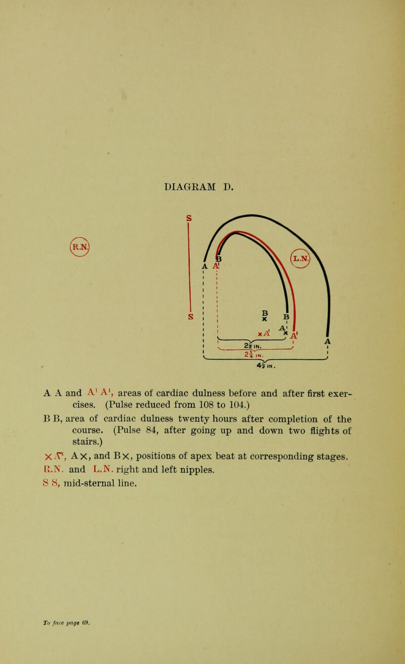 A A and A1 A1, areas of cardiac dulness before and after first exer- cises. (Pulse reduced from 108 to 104.) B B, area of cardiac dulness twenty hours after completion of the course. (Pulse 84, after going up and down two nights of stairs.) X A1, Ax, and Bx, positions of apex beat at corresponding stages. R.N. and L.N. right and left nipples. >S S, mid-sternal line.