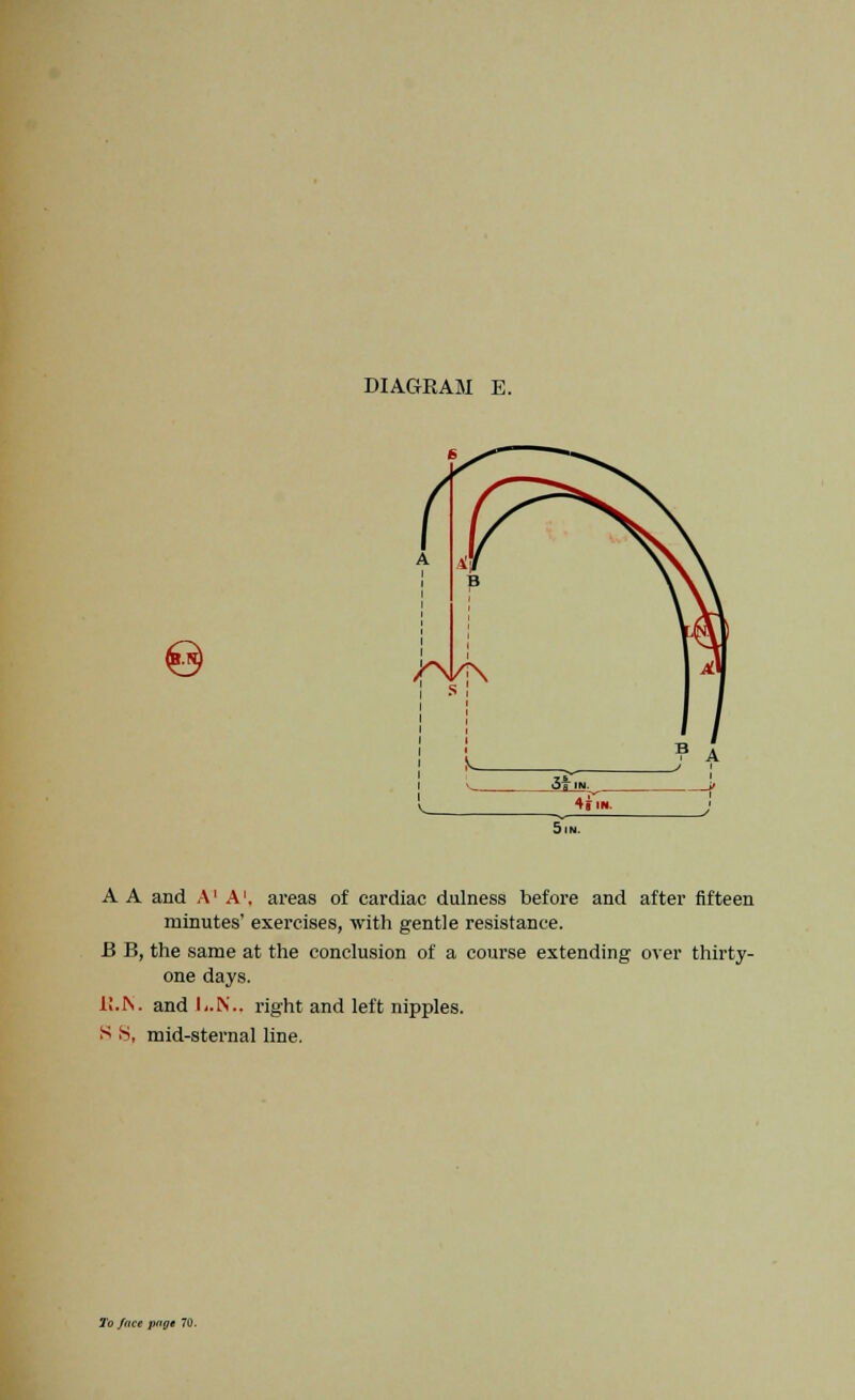 e A A and A A', areas of cardiac dulness before and after fifteen minutes' exercises, with gentle resistance. B B, the same at the conclusion of a course extending over thirty- one days. U.K. and li.N., right and left nipples. S S, mid-sternal line. lo/nce pope 70.