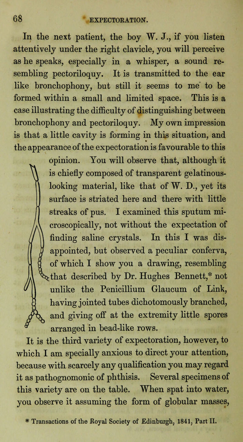 In the next patient, the boy W. J., if you listen attentively under the right clavicle, you will perceive as he speaks, especially in a whisper, a sound re- sembling pectoriloquy. It is transmitted to the ear like bronchophony, but still it seems to me to be formed within a small and limited space. This is a case illustrating the difficulty of distinguishing between bronchophony and pectoriloquy. My own impression is that a little cavity is forming in this situation, and the appearance of the expectoration is favourable to this opinion. You will observe that, although it ^ is chiefly composed of transparent gelatinous- looking material, like that of W. D., yet its surface is striated here and there with little streaks of pus. I examined this sputum mi- croscopically, not without the expectation of finding saline crystals. In this I was dis- appointed, but observed a peculiar conferva, of which I show you a drawing, resembling ►that described by Dr. Hughes Bennett,* not unlike the Penicillium Glaucum of Link, having jointed tubes dichotomously branched, and giving off at the extremity little spores arranged in bead-like rows. It is the third variety of expectoration, however, to which I am specially anxious to direct your attention, because with scarcely any qualification you may regard it as pathognomonic of phthisis. Several specimens of this variety are on the table. When spat into water, you observe it assuming the form of globular masses, * Transactions of the Royal Society of Edinburgh, 1841, Part II.