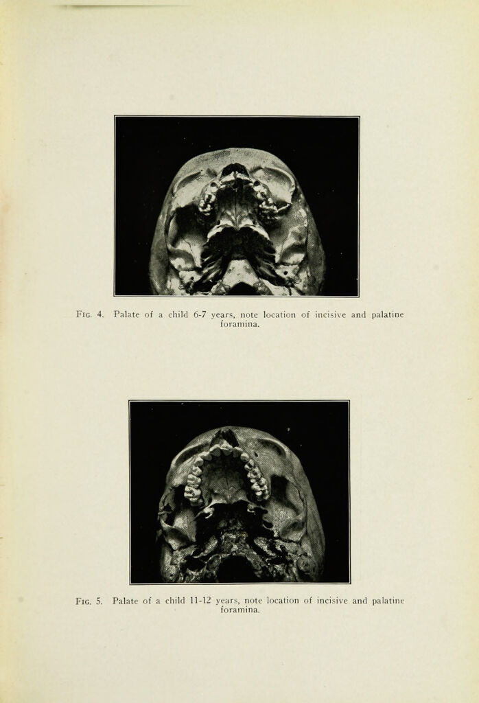 Oral anaesthesia; local anaesthesia in the oral cavity
