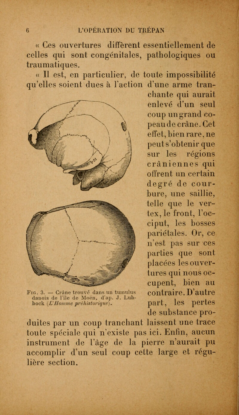 « Ces ouvertures diffèrent essentiellement de celles qui sont congénitales, pathologiques ou traumatiques. « Il est, en particulier, de toute impossibilité qu'elles soient dues à Faction d'une arme tran- chante qui aurait enlevé d'un seul coup un grand co- peau de crâne. Cet effet, bien rare, ne peut s'obtenir que sur les régions crâniennes qui offrent un certain degré de cour- bure, une saillie, telle que le ver- tex, le front, l'oc- ciput, les bosses pariétales. Or, ce n'est pas sur ces parties que sont placées les ouver- tures qui nous oc- cupent, bien au contraire. D'autre part, les pertes de substance pro- duites par un coup tranchant laissent une trace toute spéciale qui n'existe pas ici. Enfin, aucun instrument de l'âge de la pierre n'aurait pu accomplir d'un seul coup cette large et régu- lière section. Fig. 3. — Crâne trouvé dans un tumulus danois de l'île de Moën, d'ap. J. Lub- bock (Z'Homme préhistorique).