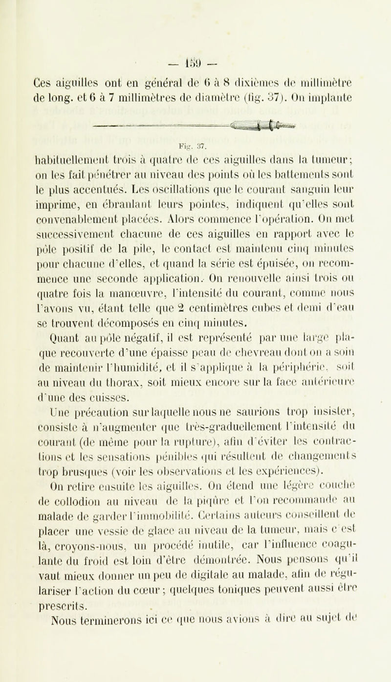 - 15<J - Ces aiguilles ont en général de <> à 8 dixièmes de millimètre de long, et 6 à 7 millimètres de diamètre (fig. 37). On implante Pig. 37. habituellement trois à quatre de ces aiguilles dans la tumeur; on les fait pénétrer au niveau des points où les battements sont le plus accentués. Les oscillations que le courant sanguin leur imprime, en ébranlant leurs pointes, indiquent qu'elles sont convenablement placées. Alors commence l'opération. On met successivement chacune de ces aiguilles en rapport avec le pôle positif de la pile, le contact est maintenu cinq minutes pour chacune d'elles, et quand la série est épuisée, on recom- mence une seconde application.- On renouvelle ainsi trois ou quatre fois la manœuvre, l'intensité du courant, comme nous l'avons vu, étant telle que 2 centimètres cubes et demi d'eau se trouvent décomposés en cinq minutes. Quant au pôle négatif, il est représenté par une large pla- que recouverte d'une épaisse peau de chevreau dont on a soin de maintenir l'humidité, et il s'applique à la périphérie, soil au niveau du thorax, soil mieux encore sur la face antérieure d'une des cuisses. Une précaution sur laquelle nous ne saurions trop insister, consiste à n'augmenter que très-graduellement l'intensité du courant (de même pour la rupture), afin d'éviter les contrac- tions et les sensations pénibles qui résultent de changements trop brusques (voir les observations et les expériences). On retire ensuite les aiguilles. On étend nue légère couche de collodion au niveau de la piqûre et l'on recommande au malade de garder l'immobilité. Certains auteurs conseillent de placer une vessie de glace au niveau de la tumeur, mais c est là, croyons-nous, un procédé inutile, car l'influence coagu- lante du froid est loin d'être démontrée. Nous pensons qu'il vaut mieux donner un peu de digitale au malade, afin de régu- lariser l'action du cœur; quelques toniques peuvent aussi être prescrits. Nous terminerons ici ce que nous avions à dire au sujet de