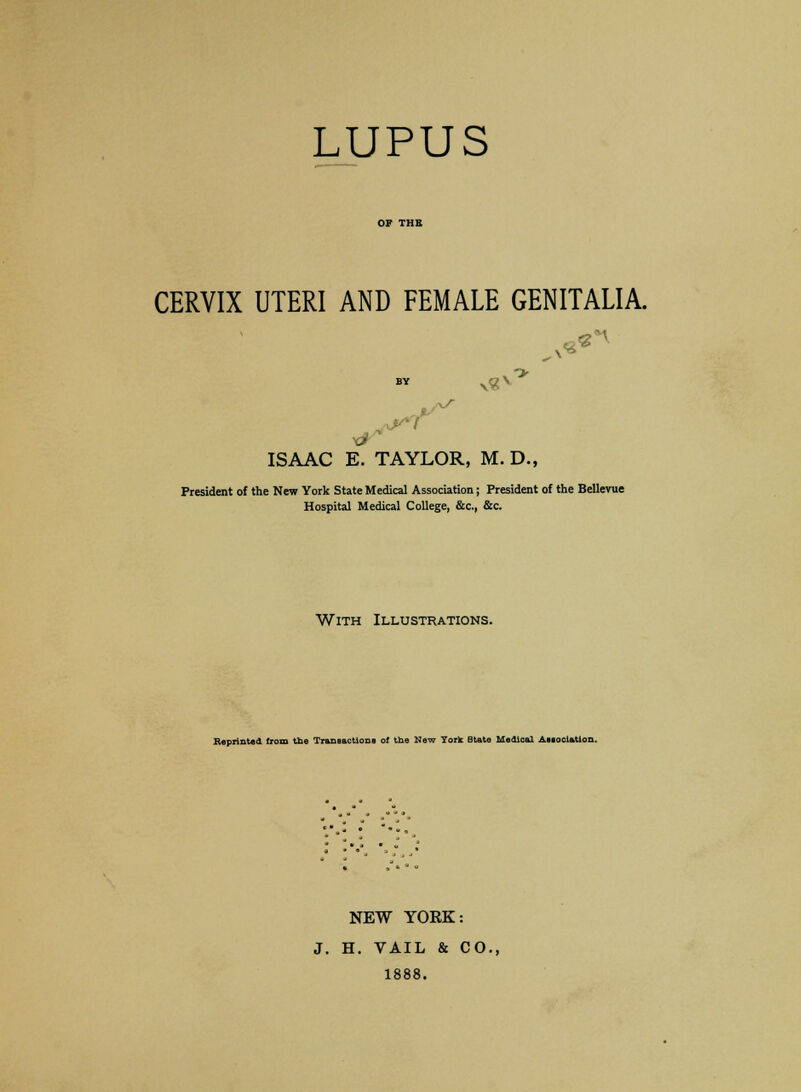 LUPUS CERVIX UTERI AND FEMALE GENITALIA. -> by xg\ ISAAC E. TAYLOR, M. D., President of the New York State Medical Association; President of the Bellevue Hospital Medical College, &c, &c. With Illustrations. Reprinted from the Transactions of the New York State Medical AieocUtion. * * * ■ NEW YORK: J. H. VAIL & CO., 1888.