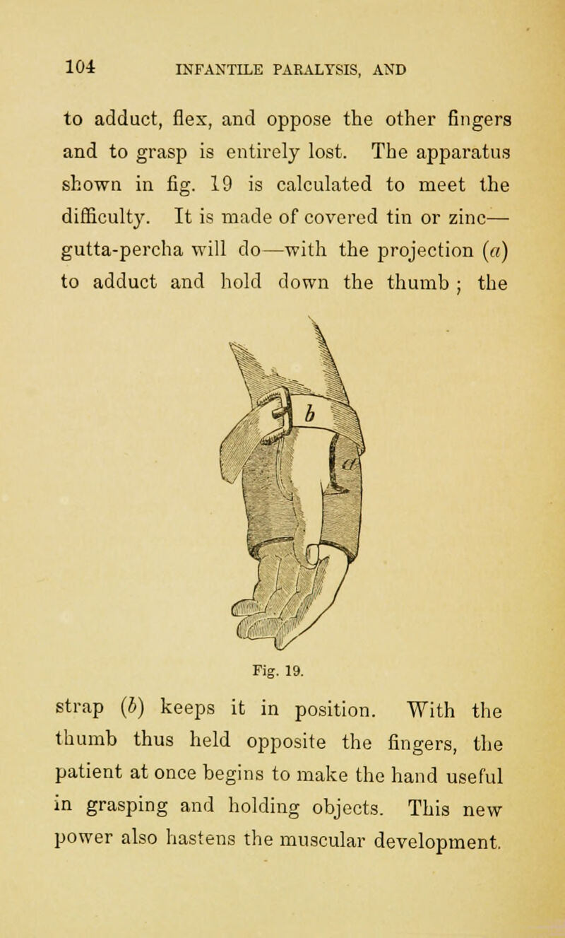 to adduct, flex, and oppose the other fingers and to grasp is entirely lost. The apparatus shown in fig. 19 is calculated to meet the difficulty. It is made of covered tin or zinc— gutta-percha will do—with the projection (a) to adduct and hold down the thumb ; the strap (b) keeps it in position. With the thumb thus held opposite the fingers, the patient at once begins to make the hand useful in grasping and holding objects. This new power also hastens the muscular development.