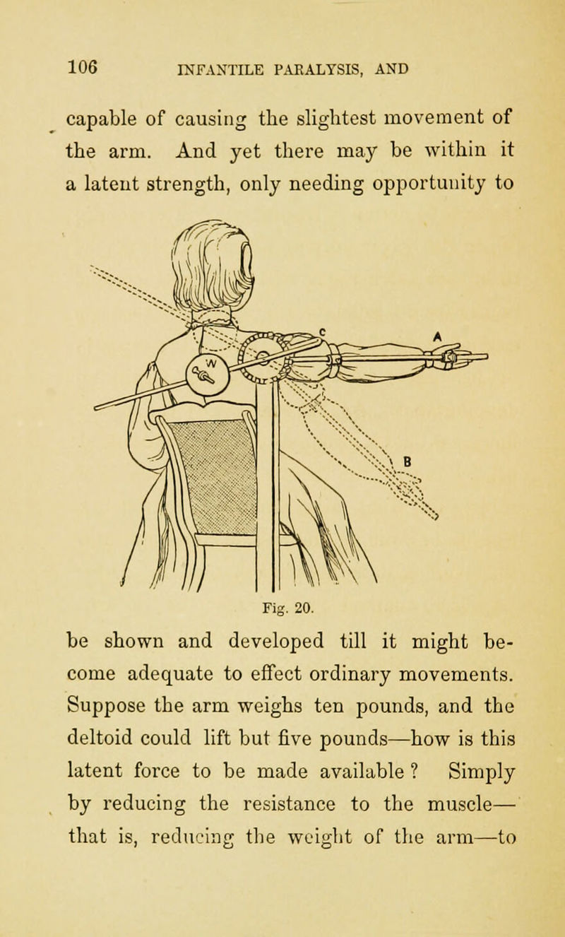 capable of causing the slightest movement of the arm. And yet there may be within it a latent strength, only needing opportunity to Fig. 20. be shown and developed till it might be- come adequate to effect ordinary movements. Suppose the arm weighs ten pounds, and the deltoid could lift but five pounds—how is this latent force to be made available ? Simply by reducing the resistance to the muscle— that is, reducing the weight of the arm—to