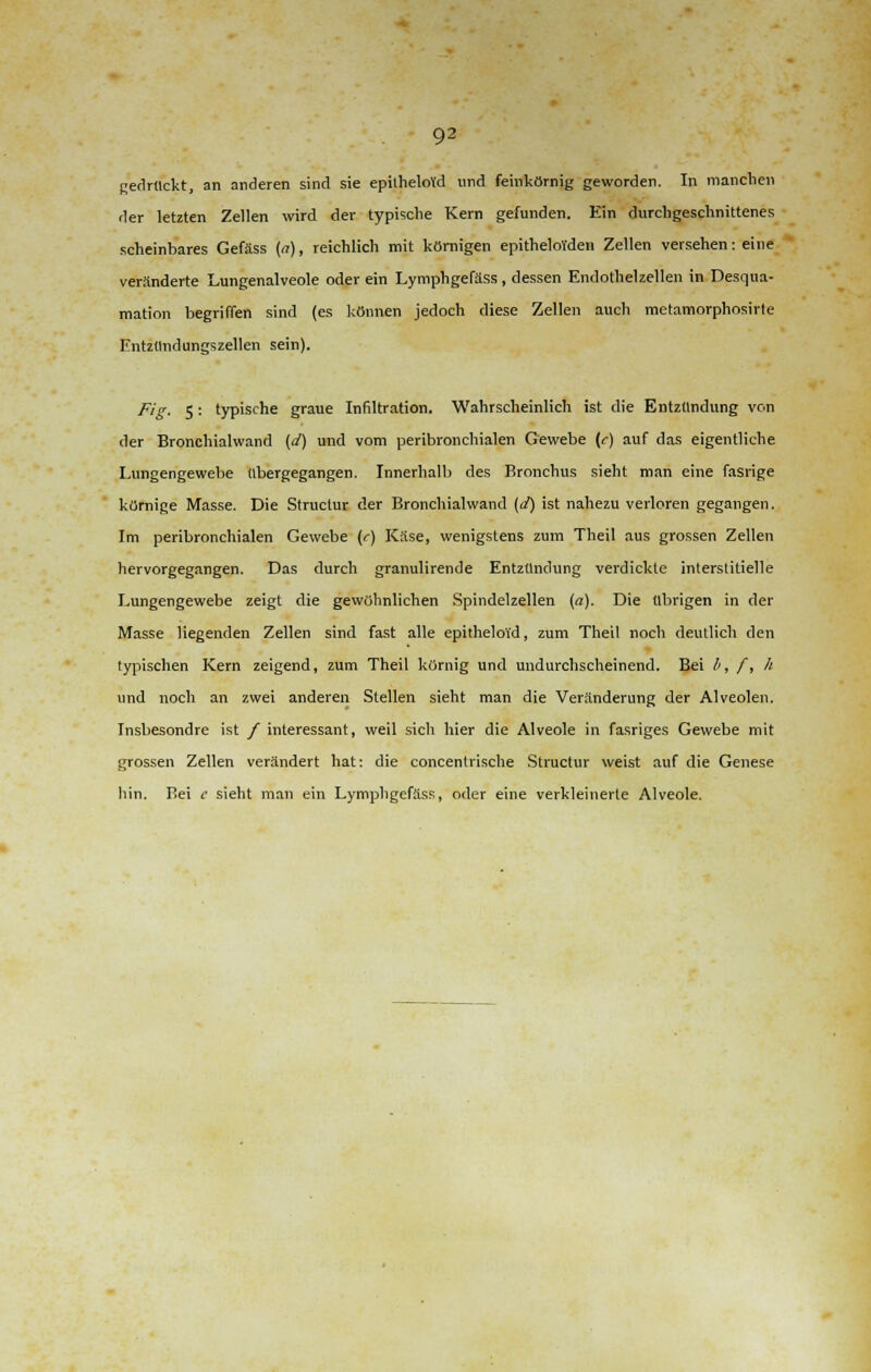 der letzten Zellen wird der typische Kern gefunden. Ein durchgeschnittenes scheinbares Gefäss (a), reichlich mit körnigen epitheloVden Zellen versehen: eine veränderte Lungenalveole oder ein Lymphgefäss , dessen Endothelzellen in Desqua- mation begriffen sind (es können jedoch diese Zellen auch metamorphosirte Entzündungszellen sein). Fig. 5: typische graue Infiltration. Wahrscheinlich ist die Entzündung von der Bronchialwand (d) und vom peribronchialen Gewebe (<-) auf das eigentliche Lungengewebe tibergegangen. Innerhalb des Bronchus sieht man eine fasrige körnige Masse. Die Structur der Bronchialwand (d) ist nahezu verloren gegangen. Im peribronchialen Gewebe (r) Käse, wenigstens zum Theil aus grossen Zellen hervorgegangen. Das durch granulirende Entzündung verdickte interstitielle Lungengewebe zeigt die gewöhnlichen Spindelzellen (a). Die übrigen in der Masse Hegenden Zellen sind fast alle epitheloi'd, zum Theil noch deutlich den typischen Kern zeigend, zum Theil körnig und undurchscheinend. Bei /', /, h und noch an zwei anderen Stellen sieht man die Veränderung der Alveolen. Insbesondre ist / interessant, weil sicli hier die Alveole in fasriges Gewebe mit grossen Zellen verändert hat: die concentrische Structur weist auf die Genese hin. Bei c sieht man ein Lymphgefäss, oder eine verkleinerte Alveole.