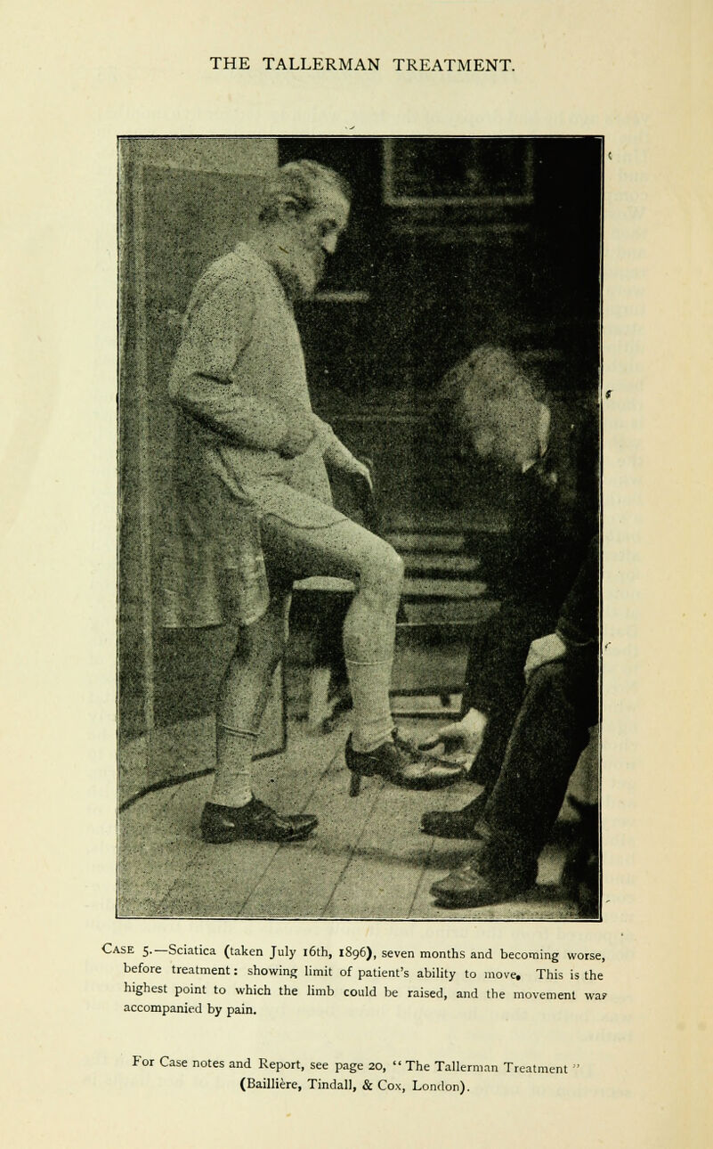 Case 5.—Sciatica (taken July i6th, 1896), seven months and becoming worse, before treatment: showing limit of patient's ability to move. This is the highest point to which the limb could be raised, and the movement wa? accompanied by pain. For Case notes and Report, see page 20,  The Tallerman Treatment '