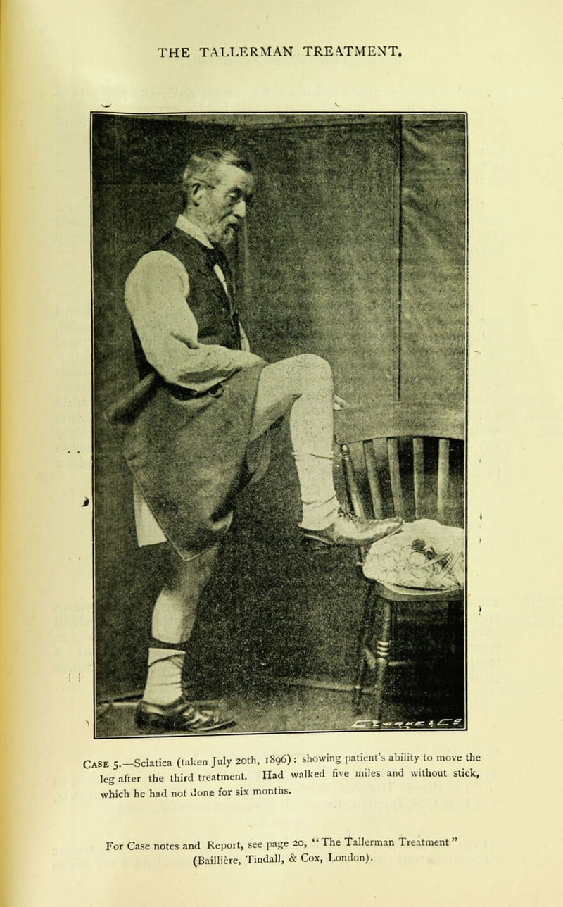 Case s.-Sciatica (taken July 20th, 1896) : showing patient's ability to move the leg after the third treatment. Had walked five miles and without stick, which he had not done for six months. For Case notes and Report, see page 20, The Tallerman Treatment'