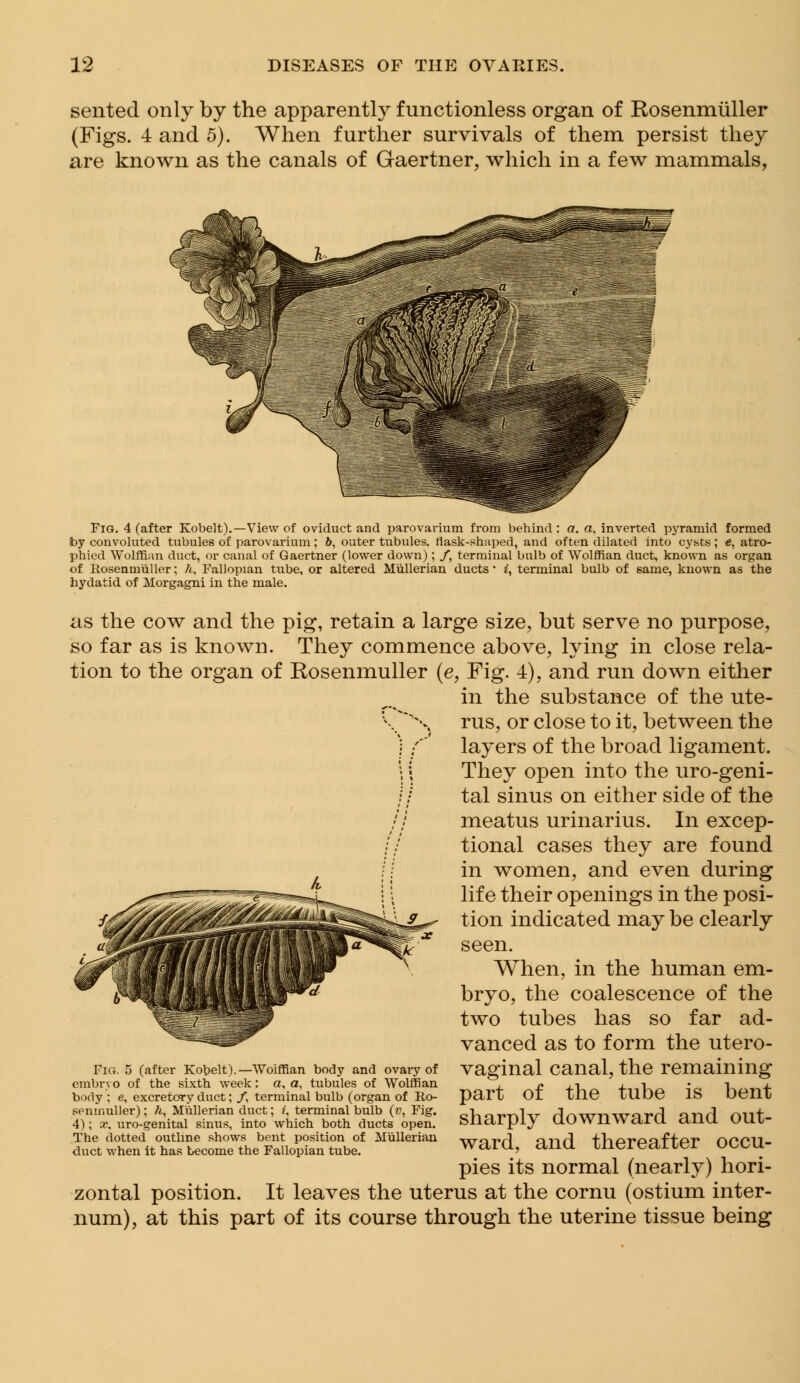 sented only by the apparently functionless organ of Rosenmiiller (Figs. 4 and 5). When further survivals of them persist they are known as the canals of Gaertner, which in a few mammals, Fig. 4 (after Kobelt).—View of oviduct and parovarium from behind : a. a. inverted pyramid formed by convoluted tubules of parovarium; 6, outer tubules, flask-shaped, and often dilated into cysts; e, atro- phied Wolffian duct, or canal of Gaertner (lower down); /, terminal bulb of Wolffian duct, known as organ of Ilosenmiiller; h, Fallopian tube, or altered Miillerian ducts' i, terminal bulb of same, known as the hydatid of Morgagni in the male. as the cow and the pig, retain a large size, but serve no purpose, so far as is known. They commence above, lying in close rela- tion to the organ of Rosenmuller (e, Fig. 4), and run down either in the substance of the ute- V~% rus, or close to it, between the ) ;'* layers of the broad ligament. '; | They open into the uro-geni- // tal sinus on either side of the // meatus urinarius. In excep- // tional cases they are found in women, and even during life their openings in the posi- tion indicated may be clearly seen. When, in the human em- bryo, the coalescence of the two tubes has so far ad- vanced as to form the utero- vaginal canal, the remaining part of the tube is bent sharply downward and out- ward, and thereafter occu- pies its normal (nearly) hori- zontal position. It leaves the uterus at the cornu (ostium inter- num), at this part of its course through the uterine tissue being Fig. 5 (after Kobelt).—Wolffian body and ovary of embryo of the sixth week: a, a, tubules of Wolffian body : e, excretory duct; /, terminal bulb (organ of Ro- senmuller) ; h, Miillerian duct; f, terminal bulb (v, Fig. 4); x. uro-genital sinus, into which both ducts open. The dotted outline shows bent position of Miillerian duct when it has become the Fallopian tube.