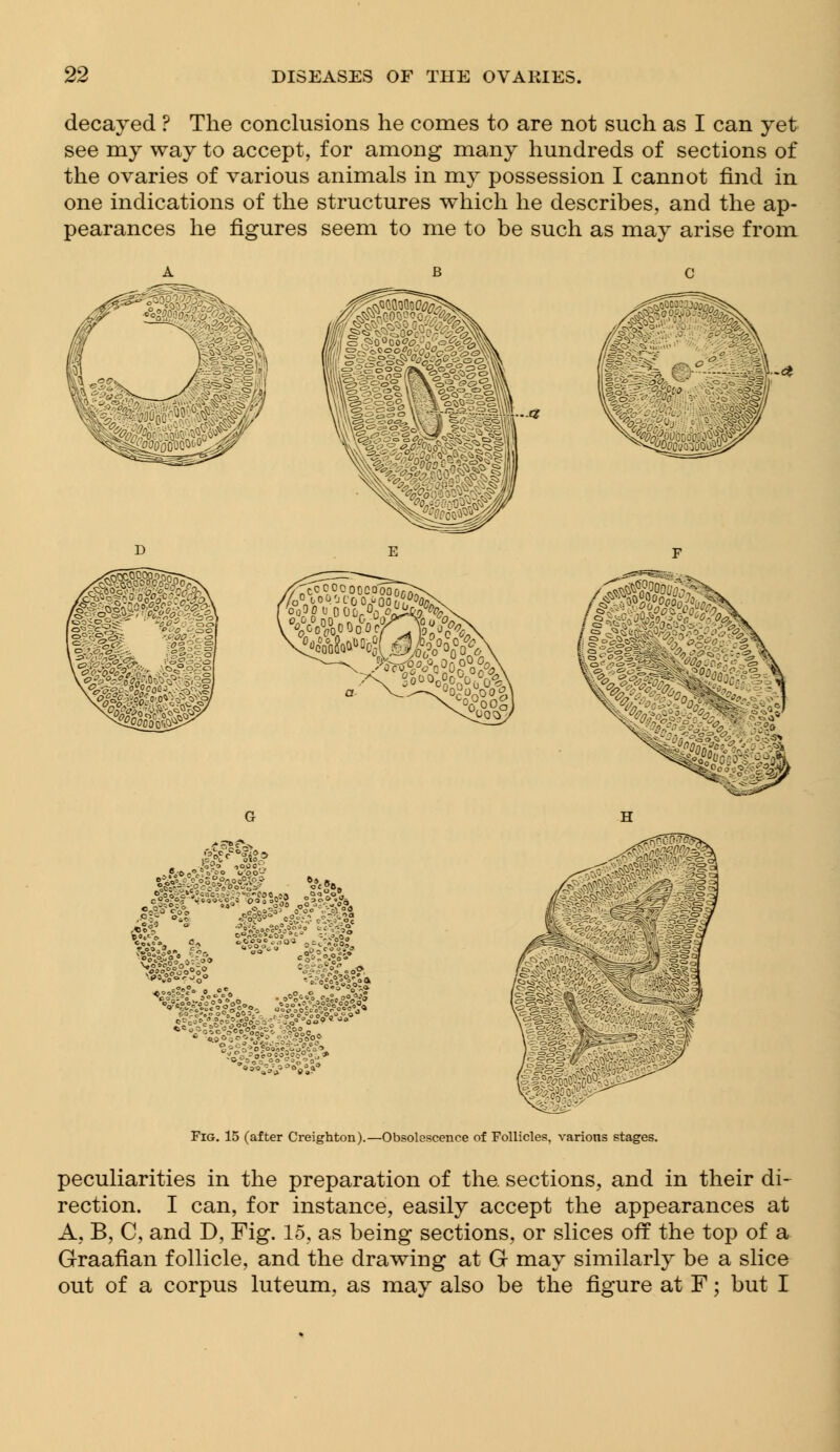 decayed ? The conclusions he comes to are not such as I can yet see my way to accept, for among many hundreds of sections of the ovaries of various animals in my possession I cannot find in one indications of the structures which he describes, and the ap- pearances he figures seem to me to be such as may arise from f;ii *%* »«.«■■» s at? A.?«. Fig. 15 (after Creighton).—Obsolescence of Follicles, various stages. peculiarities in the preparation of the sections, and in their di- rection. I can, for instance, easily accept the appearances at A, B, C, and D, Fig. 15, as being sections, or slices off the top of a Graafian follicle, and the drawing at G may similarly be a slice out of a corpus luteum, as may also be the figure at F; but I