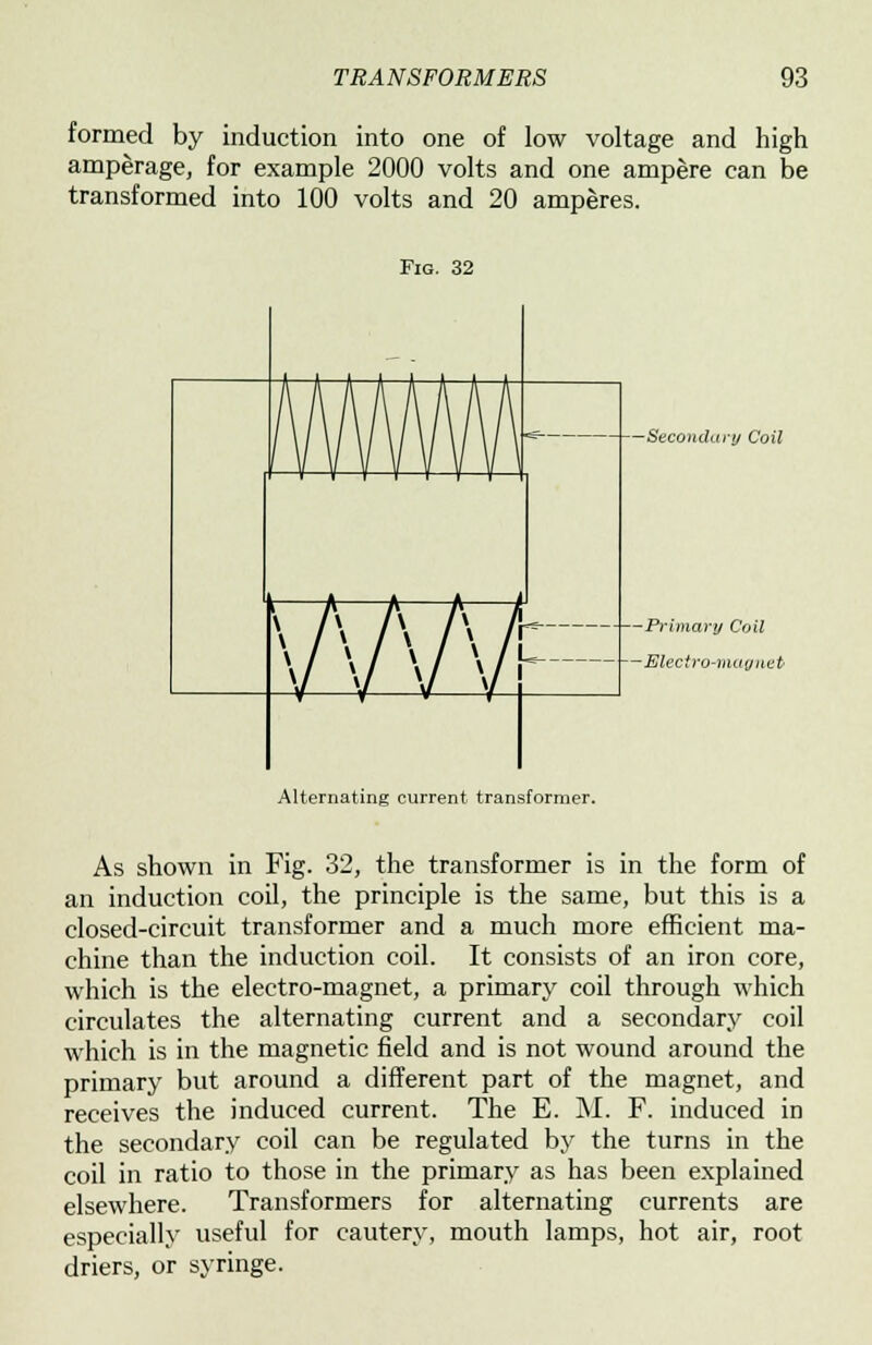 formed by induction into one of low voltage and high amperage, for example 2000 volts and one ampere can be transformed into 100 volts and 20 amperes. Fig. 32 —Secondary Coil Primary Coil Electro-magnet Alternating current transformer. As shown in Fig. 32, the transformer is in the form of an induction coil, the principle is the same, but this is a closed-circuit transformer and a much more efficient ma- chine than the induction coil. It consists of an iron core, which is the electro-magnet, a primary coil through which circulates the alternating current and a secondary coil which is in the magnetic field and is not wound around the primary but around a different part of the magnet, and receives the induced current. The E. M. F. induced in the secondary coil can be regulated by the turns in the coil in ratio to those in the primary as has been explained elsewhere. Transformers for alternating currents are especially useful for cautery, mouth lamps, hot air, root driers, or syringe.