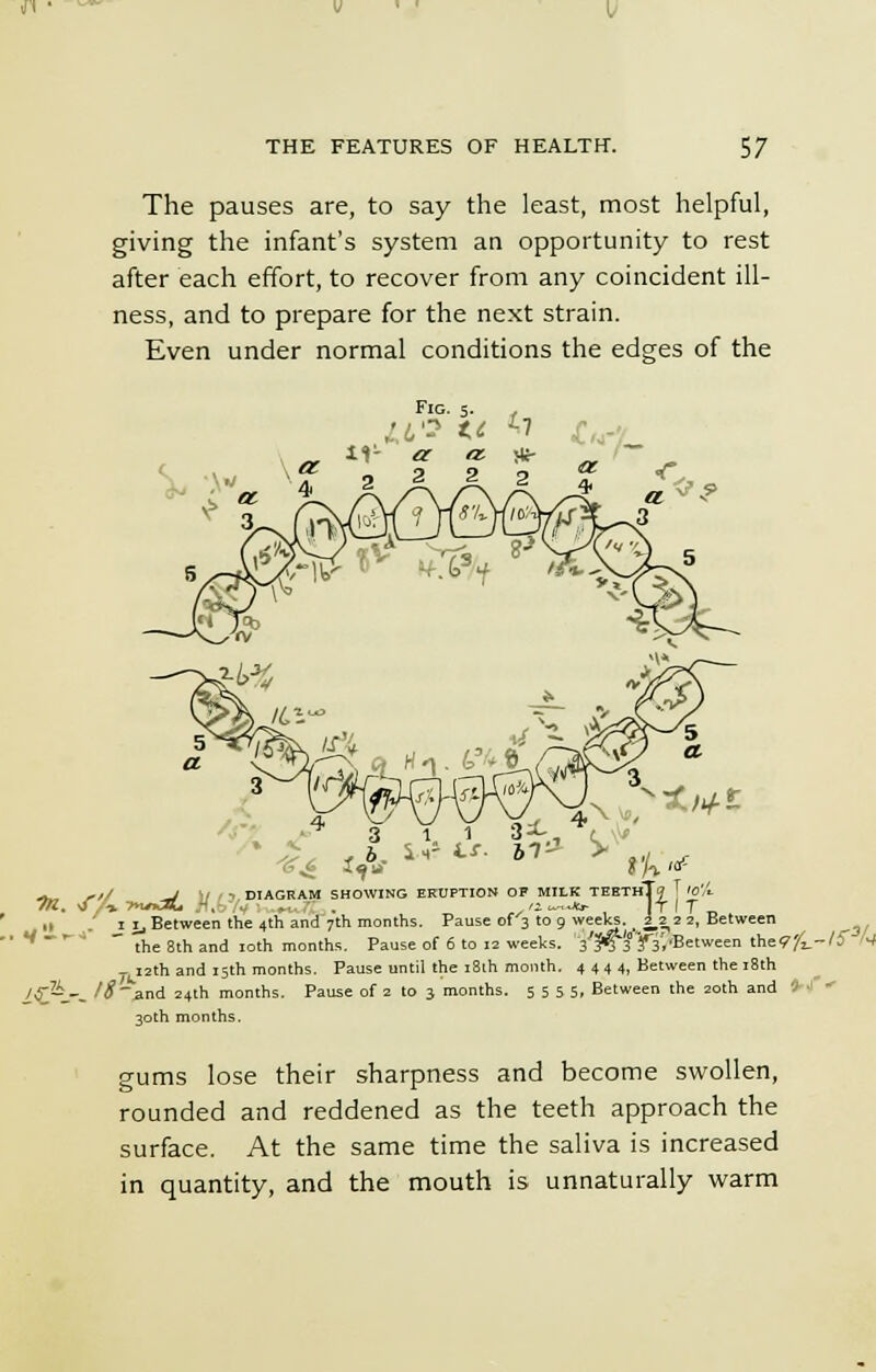 The pauses are, to say the least, most helpful, giving the infant's system an opportunity to rest after each effort, to recover from any coincident ill- ness, and to prepare for the next strain. Even under normal conditions the edges of the *W 3 .X .1 34-., ^ 6. i-r <.*• 2,7- > rk«t .-, ,// J W , , DIAGRAM SHOWING ERUPTION OF MILK TEEThT« T 'Ci M. <f ,■■*. T*m3l* fl.b/yl . /i^jo- IT I T _ ■I i i_, Between the 4th and 7th months. Pause of 3 to 9 weeks. _ 2^ 2 2, Between the 8th and 10th months. Pause of 6 to 12 weeks. V^jf ^'.'Between they^.-/5 N - 12th and 15th months. Pause until the i8lh month. 4 4 4 4, Between the 18th /,}'-_-_ /^_and 24th months. Pause of 2 to 3 months. 5 5 5 5. Between the 20th and 30th months. gums lose their sharpness and become swollen, rounded and reddened as the teeth approach the surface. At the same time the saliva is increased in quantity, and the mouth is unnaturally warm