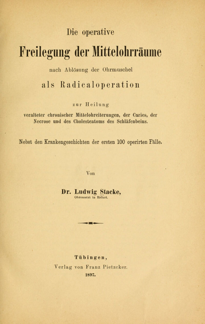 Die operative Freilegung der Mittelohrräume nach Ablösung der Ohrmuschel als Radicaloperation zur H eilung veralteter chronischer Mittelohreiterungen, der Caries, der Necrose und des Cholesteatoms des Schläfenbeins. Nebst den Krankengeschichten der ersten 100 operirten Fälle, Von Dr. Ludwig Stacke, Ohrenarzt in Erfurt. Tübingen, Verlag von Franz Pietzcker. 1897.