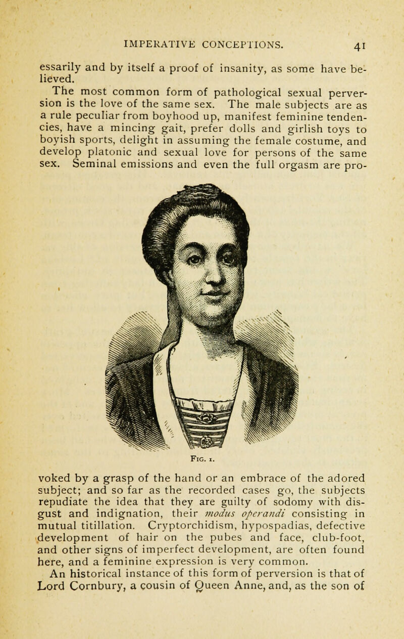 essarily and by itself a proof of insanity, as some have be- lieved. The most common form of pathological sexual perver- sion is the love of the same sex. The male subjects are as a rule peculiar from boyhood up, manifest feminine tenden- cies, have a mincing gait, prefer dolls and girlish toys to boyish sports, delight in assuming the female costume, and develop platonic and sexual love for persons of the same sex. Seminal emissions and even the full orgasm are pro- FlG. I. voked by a grasp of the hand or an embrace of the adored subject; and so far as the recorded cases go, the subjects repudiate the idea that they are guilty of sodomy with dis- gust and indignation, their modus operandi consisting in mutual titillation. Cryptorchidism, hypospadias, defective development of hair on the pubes and face, club-foot, and other signs of imperfect development, are often found here, and a feminine expression is very common. An historical instance of this form of perversion is that of Lord Cornbury, a cousin of Queen Anne, and, as the son of