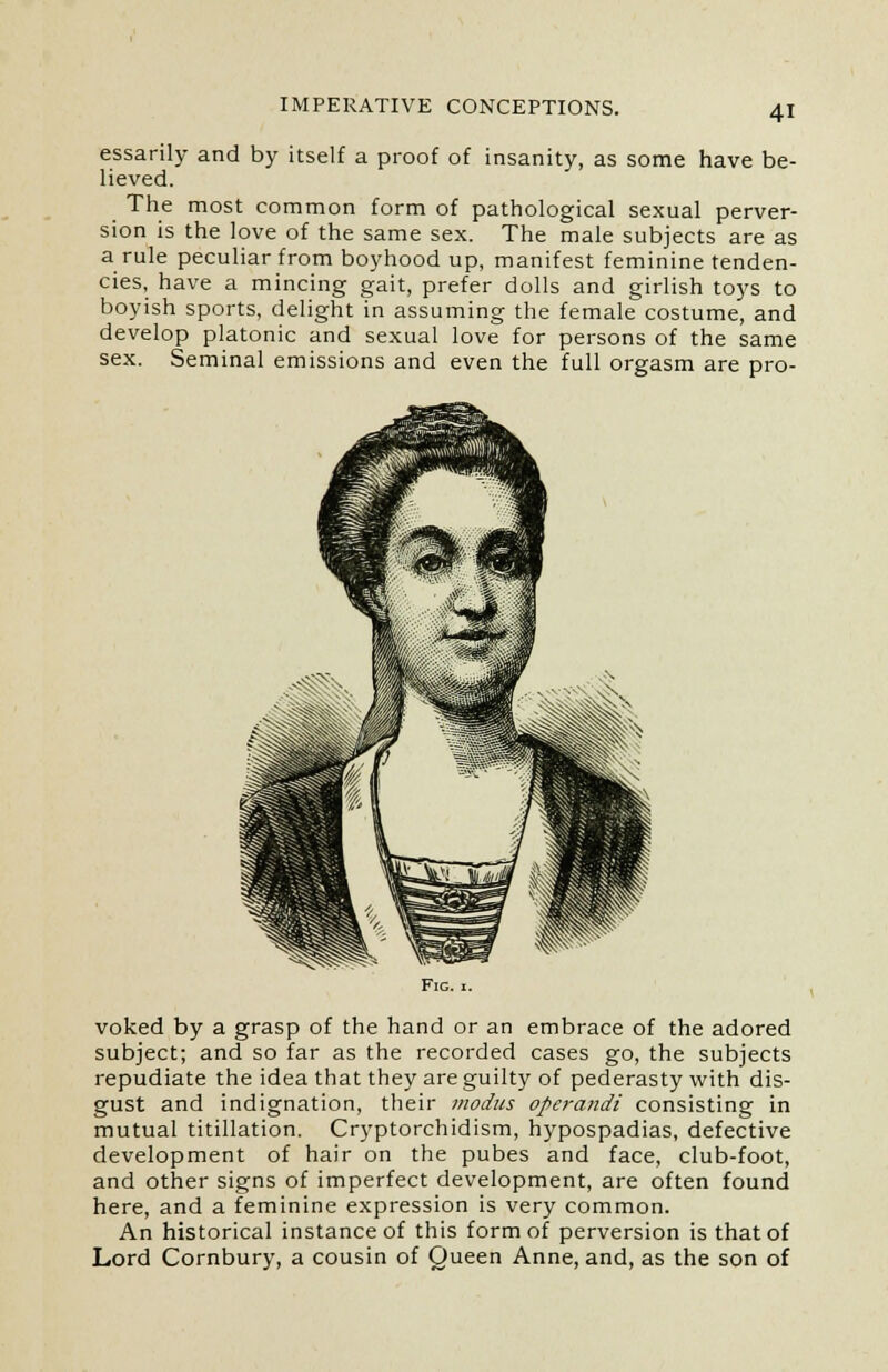 essarily and by itself a proof of insanity, as some have be- lieved. The most common form of pathological sexual perver- sion is the love of the same sex. The male subjects are as a rule peculiar from boyhood up, manifest feminine tenden- cies, have a mincing gait, prefer dolls and girlish toys to boyish sports, delight in assuming the female costume, and develop platonic and sexual love for persons of the same sex. Seminal emissions and even the full orgasm are pro- FlG. I. voked by a grasp of the hand or an embrace of the adored subject; and so far as the recorded cases go, the subjects repudiate the idea that they are guilty of pederasty with dis- gust and indignation, their modus operandi consisting in mutual titillation. Cryptorchidism, hypospadias, defective development of hair on the pubes and face, club-foot, and other signs of imperfect development, are often found here, and a feminine expression is very common. An historical instance of this form of perversion is that of Lord Cornbury, a cousin of Queen Anne, and, as the son of