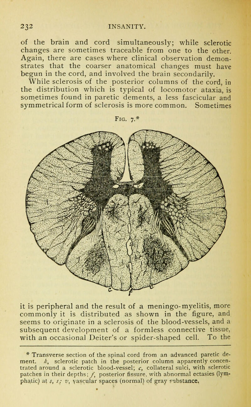 of the brain and cord simultaneously; while sclerotic changes are sometimes traceable from one to the other. Again, there are cases where clinical observation demon- strates that the coarser anatomical changes must have begun in the cord, and involved the brain secondarily. While sclerosis of the posterior columns of the cord, in the distribution which is typical of locomotor ataxia, is sometimes found in paretic dements, a less fascicular and symmetrical form of sclerosis is more common. Sometimes Fig. 7.* it is peripheral and the result of a meningo-myelitis, more commonly it is distributed as shown in the figure, and seems to originate in a sclerosis of the blood-vessels, and a subsequent development of a formless connective tissue, with an occasional Deiter's or spider-shaped cell. To the * Transverse section of the spinal cord from an advanced paretic de- ment. A, sclerotic patch in the posterior column apparently concen- trated around a sclerotic blood-vessel; c, collateral sulci, with sclerotic patches in their depths; ft posterior fissure, with abnormal ectasies (lym- phatic} at s, s; v, vascular spaces (normal) of gray substance,