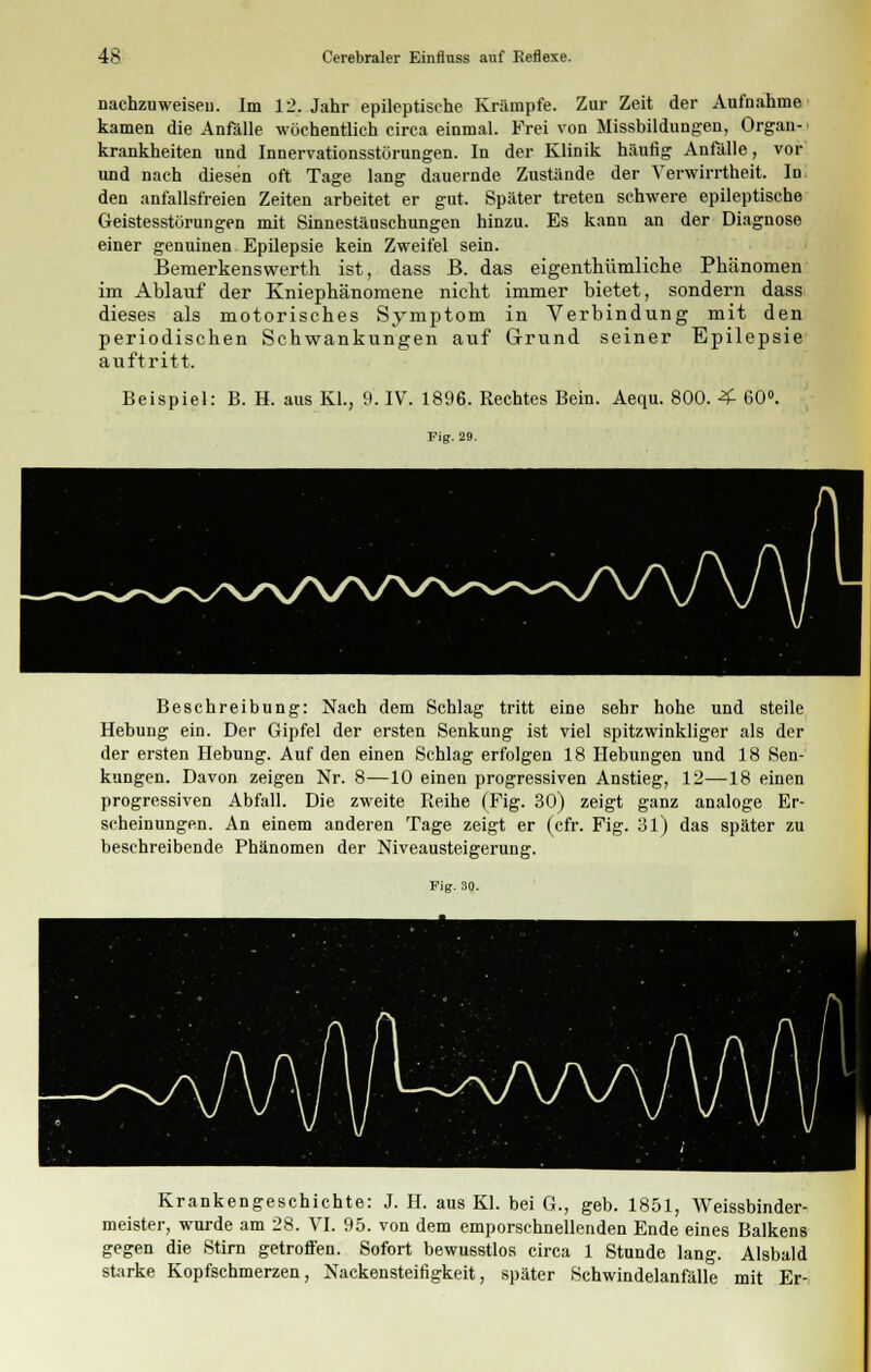 nachzuweisen Im 12. Jahr epileptische Krämpfe. Zur Zeit der Aufnahme kamen die Anfälle wöchentlich circa einmal. Frei von Missbildungen, Organ- krankheiten und Innervationsstörungen. In der Klinik häufig Anfälle, vor und nach diesen oft Tage lang dauernde Zustände der Verwirrtheit. In den anfallsfreien Zeiten arbeitet er gut. Später treten schwere epileptische Geistesstörungen mit Sinnestäuschungen hinzu. Es kann an der Diagnose einer genuinen Epilepsie kein Zweifel sein. Bemerkenswerth ist, dass B. das eigentümliche Phänomen im Ablauf der Kniephänomene nicht immer bietet, sondern dass dieses als motorisches Symptom in Verbindung mit den periodischen Schwankungen auf Grund seiner Epilepsie auftritt. Beispiel: B. H. aus KL, 9. IV. 1896. Rechtes Bein. Aequ. 800. 4- 60°. Fig. 29. Beschreibung: Nach dem Schlag tritt eine sehr hohe und steile Hebung ein. Der Gipfel der ersten Senkung ist viel spitzwinkliger als der der ersten Hebung. Auf den einen Schlag erfolgen 18 Hebungen und 18 Sen- kungen. Davon zeigen Nr. 8—10 einen progressiven Anstieg, 12—18 einen progressiven Abfall. Die zweite Reihe (Fig. 30) zeigt ganz analoge Er- scheinungen. An einem anderen Tage zeigt er (cfr. Fig. 31) das später zu beschreibende Phänomen der Niveausteigerung. Fig. 30. Krankengeschichte: J. H. aus Kl. bei G., geb. 1851, Weissbinder- meister, wurde am 28. VI. 95. von dem emporschnellenden Ende eines Balkens gegen die Stirn getroffen. Sofort bewusstlos circa 1 Stunde lang. Alsbald starke Kopfschmerzen, Nackensteifigkeit, später Schwindelanfälle mit Er-