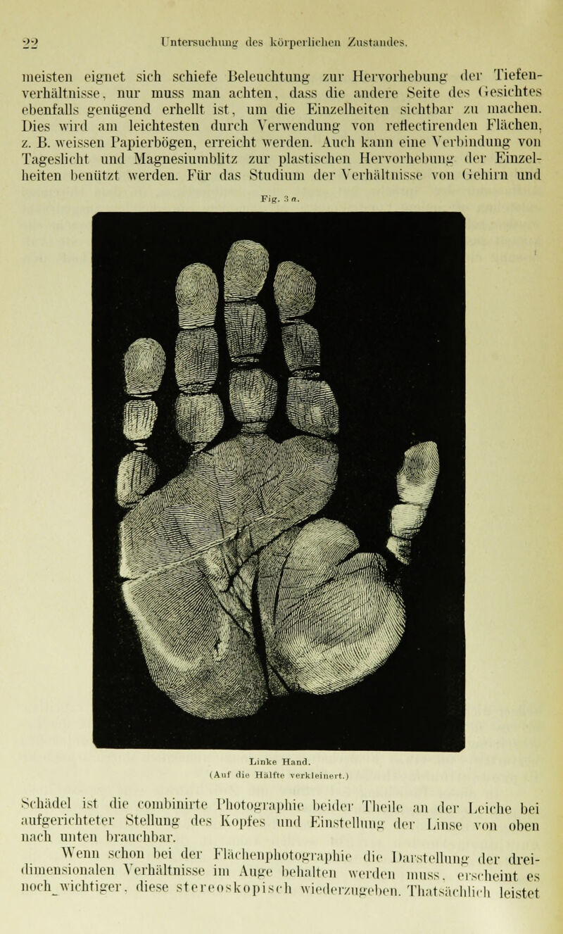 meisten eignet sich schiefe Beleuchtung zur Hervorhebung der Tiefen-- Verhältnisse, nur muss man achten, dass die andere Seite des Gesichtes ebenfalls genügend erhellt ist, um die Einzelheiten sichtbar zu machen. Dies wird am leichtesten durch Verwendung von reflectirenden Flächen, z. B. weissen Papierbögen, erreicht werden. Auch kann eine Verbindung von Tageslicht und Magnesiuniblitz zur plastischen Hervorhebung der Einzel- heiten benützt werden. Für das Studium der Verhältnisse von Gehirn und Linke Hand. (Auf die Hälfte verkleinert.) beider Einstel Theile an der Leiche bei ung der Linse von oben Schädel ist die combinirte Photographie aufgerichteter Stellung des Kopfes und nach unten brauchbar. Wenn schon bei der Flächenphotographie die Üar-stellung der drei- dimensionalen Verhältnisse im Auge behalten werden muss. erscheint es noch^wichtiger, diese stereoskopisch wiederzugeben. Thatsächlich leistet