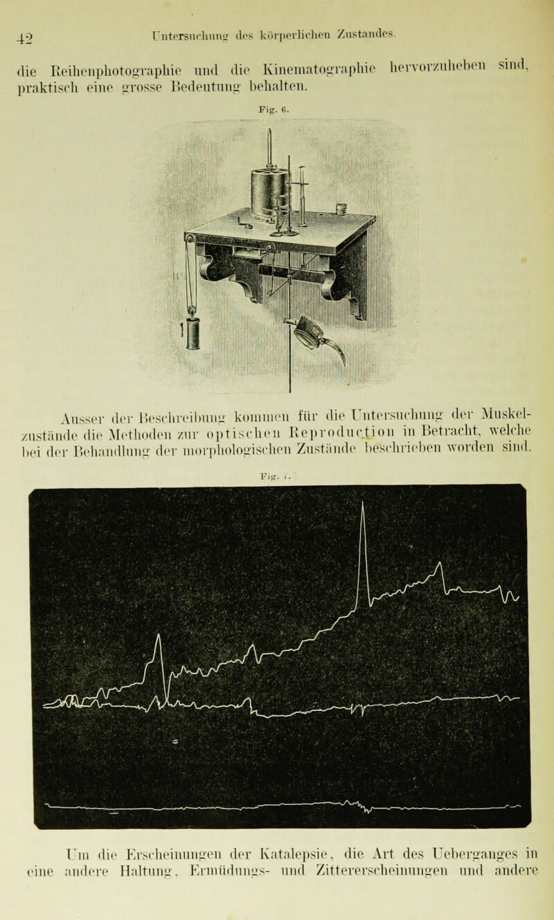 die Reihenphotographie und die Kinematographie hervorzuheben sind praktisch eine grosse Bedeutung behalten. Fi. G. Ausser der Beschreibung kommen für die Untersuchung der Muskel- zustände die Methoden zur optischen Reproducjjon in Betracht, welche bei der Behandlung der morphologischen Zustande beschrieben worden sind. Tili die Erscheinungen der Katalepsie, die Art des Ueberganges in eine andere Haltung, Ermüdungs- und Zittererscheinungen und andere