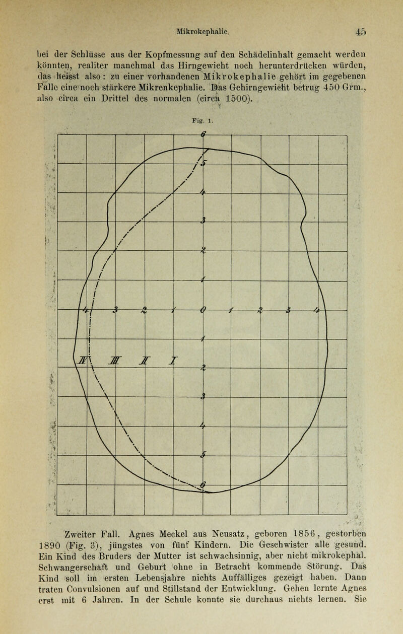 bei der Schlüsse aus der Kopfmessnng auf den Schädelinhalt gemacht werden könnten, realiter manchmal das Hirngewicht noch herunterdrucken würden, das lieisst also: zu einer vorhandenen Mikrokephalie gehört im gegebenen Falle eine noch stärkere Mikrenkephalie. Bas Gehirngewieht betrug 450 Grm., also circa ein Drittel des normalen (circa. 1500). Pig 1. a 1 / / / i m. r i / / > , f / / / / / * ! / / \ l £ / • • \ 7 i f * * f ' ' \Jk i | \ 1 r j r j r 9 > \ \ \ \ f ' \ \ i » \ > \ ' ' ? 1 ^ *-jj Zweiter Fall. Agnes Meckel aus Neusatz, geboren 1856, gestorben 1890 (Fig. 3), jüngstes von fünf Kindern. Die Geschwister alle gesund. Ein Kind des Bruders der Mutter ist schwachsinnig, aber nicht mikrokephal. Schwangerschaft und Geburt ohne in Betracht kommende Störung. Das Kind soll im ersten Lebensjahre nichts Auffälliges gezeigt haben. Dann traten Convulsionen auf und Stillstand der Entwicklung. Gehen lernte Agnes erst mit 6 Jahren. In der Schule konnte sie durchaus nichts lernen. Sie