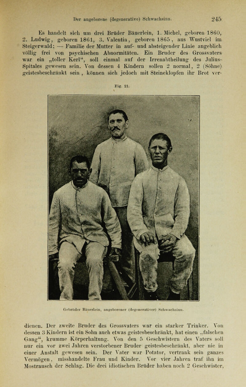 Es handelt sich um drei Brüder Bäuerlein, 1. Michel, geboren 1860, 2. Ludwig-, geboren 1861, 3. Valentin, geboren 1865, aus Wustviel im Steigerwald; — Familie der Mutter in auf- und absteigender Linie angeblich völlig frei von psychischen Abnormitäten. Ein Bruder des Grossvaters war ein „toller Kerl, soll einmal auf der Irrenabtheilung des Julius- Spitales gewesen sein. Von dessen 4 Kindern sollen 2 normal, 2 (Söhne) geistesbeschränkt sein , können sich jedoch mit Steineklopfen ihr Brot ver- Fig. 21. Gebriider Bänerlein, angeborener (degenerativer) Schwachsinn. dienen. Der zweite Bruder des Grossvaters war ein starker Trinker. Von dessen o Kindern ist ein Sohn auch etwas geistesbeschränkt, hat einen „falschen Gang, krumme Körperhaltung. Von den 5 Geschwistern des Vaters soll nur ein vor zwei Jahren verstorbener Bruder geistesbeschränkt, aber nie in einer Anstalt gewesen sein. Der Vater war Potator, vertrank sein ganzes Vermögen, misshandelte Frau und Kinder. Vor vier Jahren traf ihn im Mostrausch der Schlag. Die drei idiotischen Brüder haben noch 2 Geschwister,