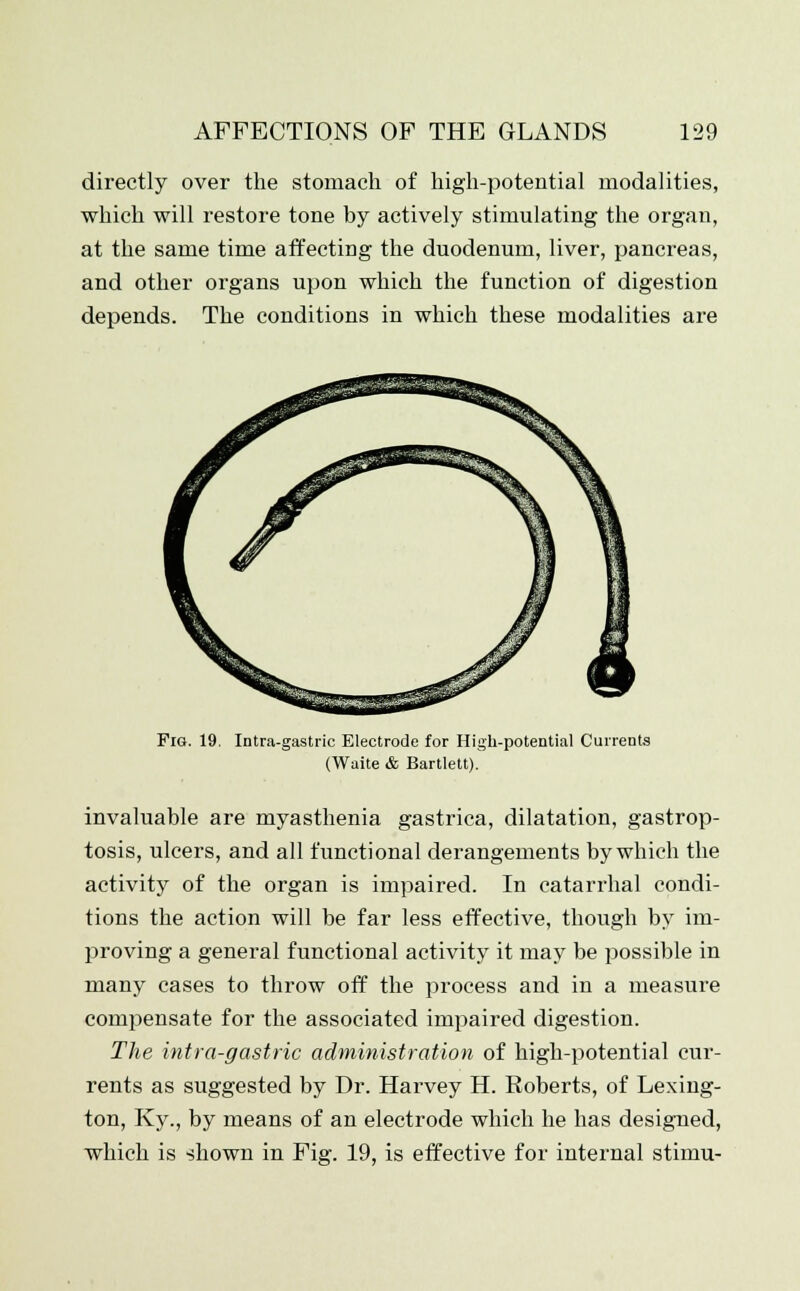 directly over the stomach of high-potential modalities, which will restore tone by actively stimulating the organ, at the same time affecting the duodenum, liver, pancreas, and other organs upon which the function of digestion depends. The conditions in which these modalities are Fig. 19. Intra-gastric Electrode for High-potential Currents (Waite & Bartlett). invaluable are myasthenia gastrica, dilatation, gastrop- tosis, ulcers, and all functional derangements by which the activity of the organ is impaired. In catarrhal condi- tions the action will be far less effective, though by im- proving a general functional activity it may be possible in many cases to throw off the process and in a measure compensate for the associated impaired digestion. The intra-gastric administration of high-potential cur- rents as suggested by Dr. Harvey H. Roberts, of Lexing- ton, Ky., by means of an electrode which he has designed, which is shown in Fig. 19, is effective for internal stimu-