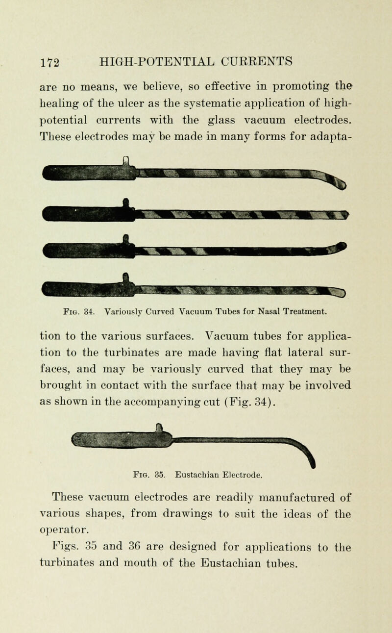 are no means, we believe, so effective in promoting the healing of the ulcer as the systematic application of high- potential currents with the glass vacuum electrodes. These electrodes may be made in many forms for adapta- Fig. 34. Variously Curved Vacuum Tubes for Nasal Treatment. tion to the various surfaces. Vacuum tubes for applica- tion to the turbinates are made having flat lateral sur- faces, and may be variously curved that they may be brought in contact with the surface that may be involved as shown in the accompanying cut (Fig. 34). Fig. 35. Eustachian Electrode. N These vacuum electrodes are readily manufactured of various shapes, from drawings to suit the ideas of the operator. Figs. 35 and 36 are designed for applications to the turbinates and mouth of the Eustachian tubes.