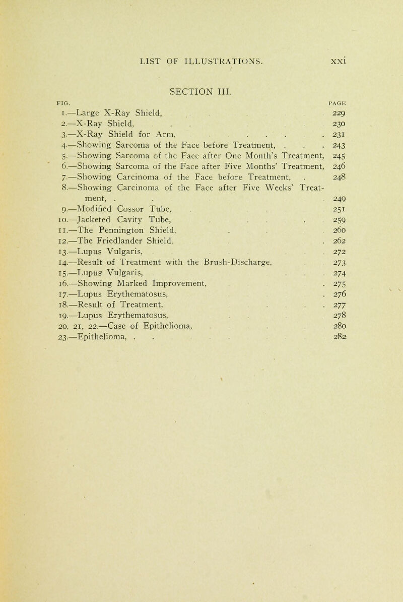 SECTION III. FIG. PAGK I.—Large X-Ray Shield, 229 2.—X-Ray Shield. . . 230 3.—X-Ray Shield for Arm, ... .231 4.—Showing Sarcoma of the Face before Treatment, . . . 243 5.—Showing Sarcoma of the Face after One Month's Treatment, 245 6.—Showing Sarcoma of the Face after Five Months' Treatment, 246 7.—Showing Carcinoma of the Face before Treatment, . 248 8.—Showing Carcinoma of the Face after Five Weeks' Treat- ment, . . 249 9.—Modified Cossor Tube. . 251 10.—Jacketed Cavity Tube, . 259 II.—The Pennington Shield. . 260 12.—The Friedlander Shield, 262 13.—Lupus Vulgaris, 272 14.—Result of Treatment with the Brush-Discharge, 273 15.—Lupus Vulgaris, , 274 16.—Showing Marked Improvement, . 275 17.—Lupus Erythematosus, . 276 18.—Result of Treatment, . . 277 19.—Lupus Erythematosus, 278 20, 21, 22.—Case of Epithelioma, 280 23.—Epithelioma, . . 282