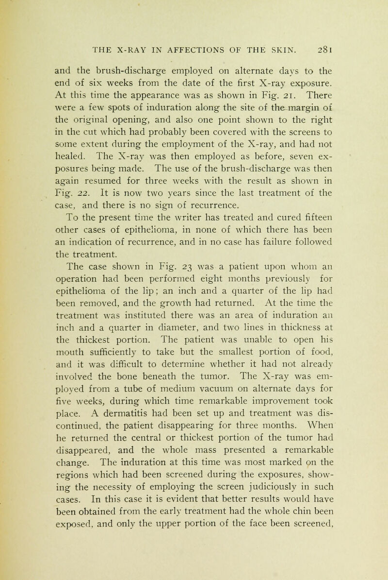 and the brush-discharge employed on alternate days to the end of six weeks from the date of the first X-ray exposure. At this time the appearance was as shown in Fig. 21. There were a few spots of induration along the site of the margin of the original opening, and also one point shown to the right in the cut which had probably been covered with the screens to some extent during the employment of the X-ray, and had not healed. The X-ray was then employed as before, seven ex- posures being made. The use of the brush-discharge was then again resumed for three weeks with the result as shown in Fig. 22. It is now two years since the last treatment of the case, and there is no sign of recurrence. To the present time the writer has treated and cured fifteen other cases of epithelioma, in none of which there has been an indication of recurrence, and in no case has failure followed the treatment. The case shown in Fig. 23 was a patient upon whom an operation had been performed eight months previously for epithelioma of the lip; an inch and a quarter of the lip had been removed, and the growth had returned. At the time the treatment was instituted there was an area of induration an inch and a quarter in diameter, and two lines in thickness at the thickest portion. The patient was unable to open his mouth sufficiently to take but the smallest portion of food, and it was difficult to determine whether it had not already involved the bone beneath the tumor. The X-ray was em- ployed from a tube of medium vacuum on alternate days for five weeks, during which time remarkable improvement took place. A dermatitis had been set up and treatment was dis- continued, the patient disappearing for three months. When he returned the central or thickest portion of the tumor had disappeared, and the whole mass presented a remarkable change. The induration at this time was most marked on the regions which had been screened during the exposures, show- ing the necessity of employing the screen judiciously in such cases. In this case it is evident that better results would have been obtained from the early treatment had the whole chin been exposed, and only the upper portion of the face been screened,
