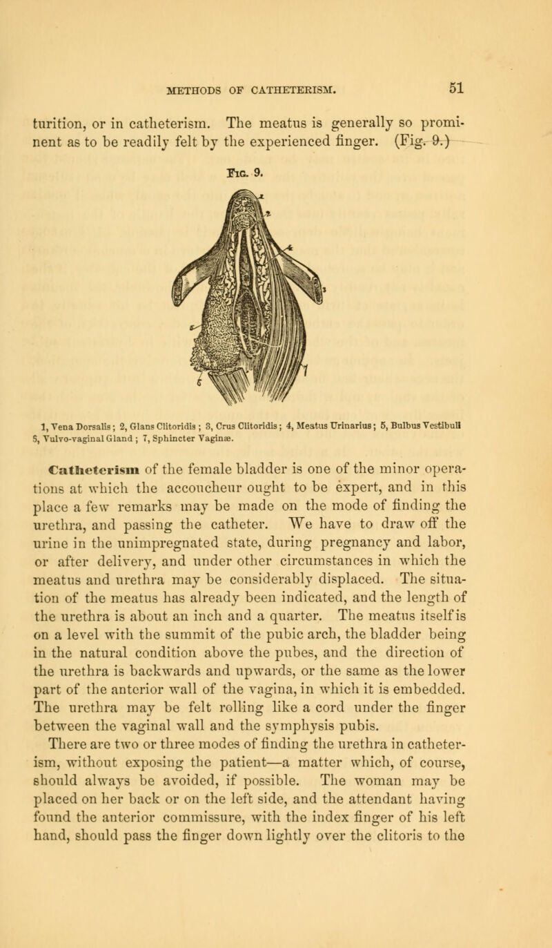 turition, or in catheterism. The meatus is generally so promi- nent as to be readily felt by the experienced finger. (Fig. 9.) Fig. 9. 1, Tena Dorsalis; 2, Glans Clitoridis ; 3, Crus Clitoridis; 4, Meatus Urinarius; 5, Bulbus Vestibull S, Vulvovaginal Gland ; 7, Sphincter Vaginae. Catheterism of the female bladder is one of the minor opera- tions at which the accoucheur ought to be expert, and in this place a few remarks may be made on the mode of finding the urethra, and passing the catheter. We have to draw off the urine in the unimpregnated state, during pregnancy and labor, or after delivery, and under other circumstances in which the meatus and urethra may be considerably displaced. The situa- tion of the meatus has already been indicated, and the length of the urethra is about an inch and a quarter. The meatus itself is on a level with the summit of the pubic arch, the bladder being in the natural condition above the pubes, and the direction of the urethra is backwards and upwards, or the same as the lower part of the anterior wall of the vagina, in which it is embedded. The urethra may be felt rolling like a cord under the finger between the vaginal wall and the symphysis pubis. There are two or three modes of finding the urethra in catheter- ism, without exposing the patient—a matter which, of course, should always be avoided, if possible. The woman may be placed on her back or on the left side, and the attendant having found the anterior commissure, with the index finger of his left hand, should pass the finger down lightly over the clitoris to the