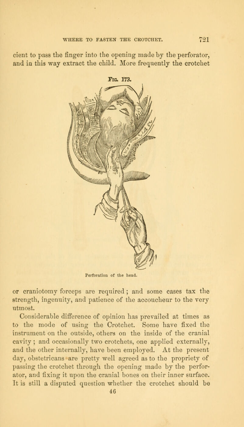 cient to pass the finger into the opening made by the perforator, and in this way extract the child. More frequently the crotchet Fig. 173. Perforation of the head. or craniotomy forceps are required ; and some cases tax the strength, ingenuity, and patience of the accoucheur to the very utmost. Considerable difference of opinion has prevailed at times as to the mode of using the Crotchet. Some have fixed the instrument on the outside, others on the inside of the cranial cavity ; and occasionally two crotchets, one applied externally, and the other internally, have been employed. At the present day, obstetricans are pretty well agreed as to the propriety of passing the crotchet through the opening made by the perfor- ator, and fixing it upon the cranial bones on their inner surface. It is still a disputed question whether the crotchet should be 46