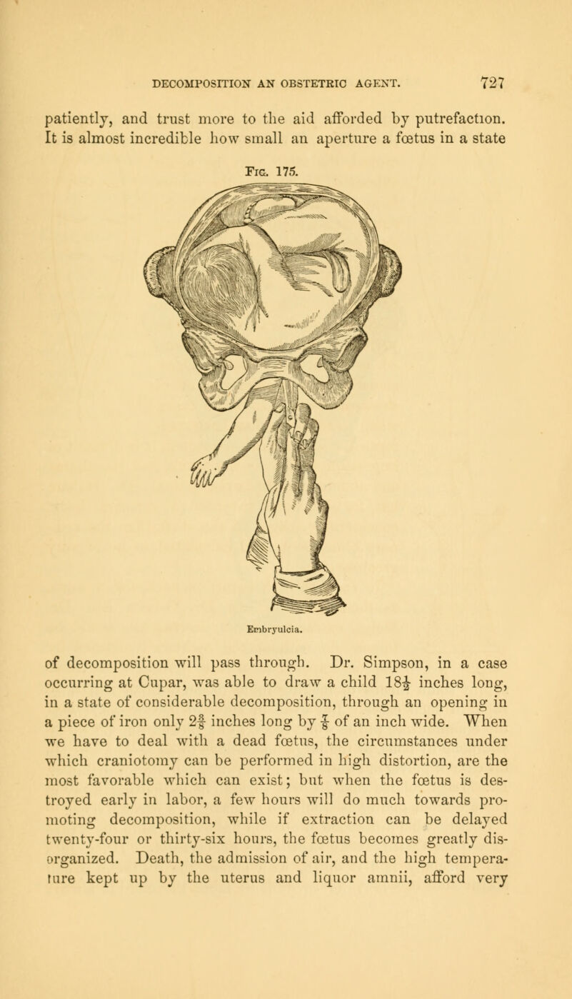 patiently, and trust more to the aid afforded by putrefaction. It is almost incredible how small an aperture a foetus in a state Fig. 175. Embryulcia. of decomposition will pass through. Dr. Simpson, in a case occurring at Cupar, was able to draw a child 18-J- inches long, in a state of considerable decomposition, through an opening in a piece of iron only 2f inches long by f- of an inch wide. When we have to deal with a dead foetus, the circumstances under which craniotomy can be performed in high distortion, are the most favorable which can exist; but when the foetus is des- troyed early in labor, a few hours will do much towards pro- moting decomposition, while if extraction can be delayed twenty-four or thirty-six hours, the foetus becomes greatly dis- organized. Death, the admission of air, and the high tempera- fare kept up by the uterus and liquor amnii, afford very