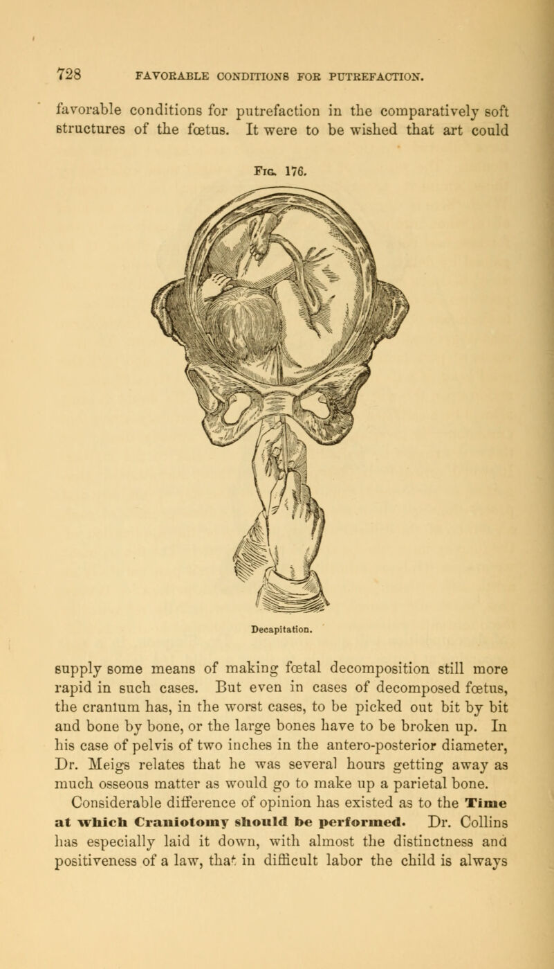 favorable conditions for putrefaction in the comparatively soft structures of the foetus. It were to be wished that art could Fig. 176. Decapitation. supply some means of making foetal decomposition still more rapid in such cases. But even in cases of decomposed foetus, the cranium has, in the worst cases, to be picked out bit by bit and bone by bone, or the large bones have to be broken up. In his case of pelvis of two inches in the antero-posterior diameter, Dr. Meigs relates that he was several hours getting away as much osseous matter as would go to make up a parietal bone. Considerable difference of opinion has existed as to the Tinie at which Craniotomy should be performed. Dr. Collins has especially laid it down, with almost the distinctness and positiveness of a law, tha* in difficult labor the child is always