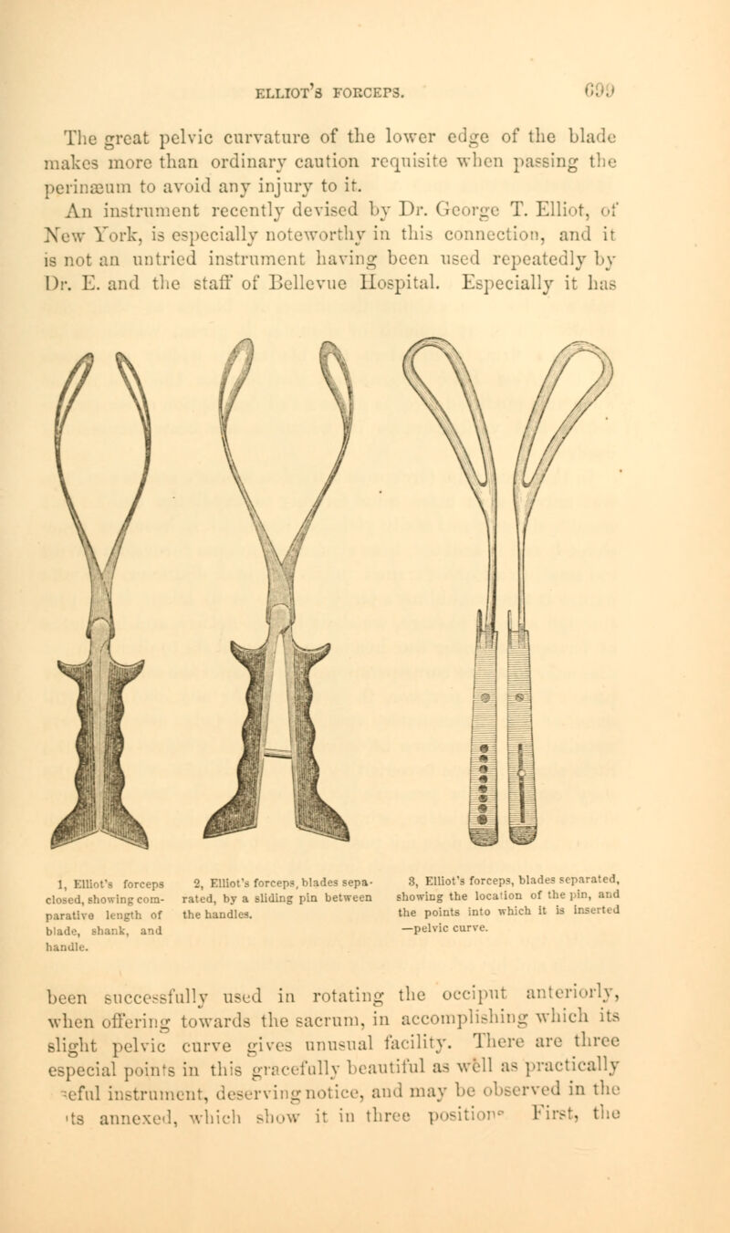 ELLIOT 3 FOECEP3. The great pelvic curvature of the lower edge of the blade makes more than ordinary caution requisite when passing the perinSBum to avoid any injury to it. An instrument recently devised by Dr. George T. Elliot, of New York, is especially noteworthy in this connection, and it is not an untried instrument having been used repeatedly by Dr. E. and the staff of Bellevue Hospital. Especially it lias 1, Elliot's forceps closed, showing com- parative length of blade, shank, and handle. 2, Elliot's forceps, blades sepa- rated, by a sliding pin between the handles. 3, Elliot's forceps, blades separated, showing the location of the pin, and the points into which it is Inserted —pelvic curve. been successfully used in rotating the occiput anteriorly, when offering towards the sacrum, in accomplishing which its slight pelvic curve gives anusnal facility. There are three especial points in this gracefully beautiful as well as practically ^eful instrument, deserving notice, and may be observed in the <ts annexed, which show it in three position* First, the