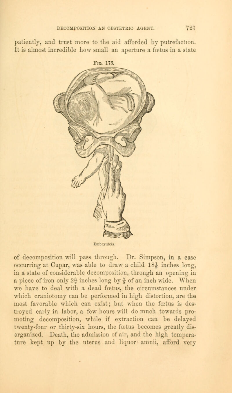 DECOMPOSITION AN OBSTETRIC AGENT. 721 patiently, and trust more to the aid afforded by putrefaction. It is almost incredible how small an aperture a foetus in a state Fig. 175. Embryulcia. of decomposition will pass through. Dr. Simpson, in a case occurring at Cupar, was able to draw a child 1S£ inches long, in a state of considerable decomposition, through an opening in a piece of iron only 2f inches long by £■ of an inch wide. When we have to deal with a dead foetus, the circumstances under which craniotomy can be performed in high distortion, are the most favorable which can exist; but when the foetus is des- troyed early in labor, a few hours will do much towards pro- moting decomposition, while if extraction can be delayed twenty-four or thirty-six hours, the foetus becomes greatly dis- organized. Death, the admission of air, and the high tempera- ture kept up by the uterus and Liquor amnii, afford very