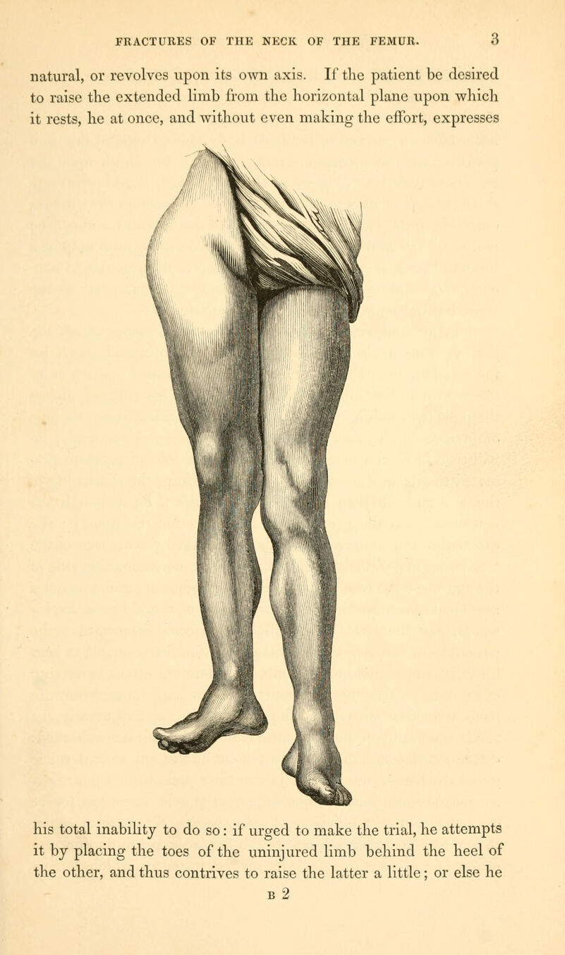 natural, or revolves upon its own axis. If the patient be desired to raise the extended limb from the horizontal plane upon which it rests, he at once, and without even making the effort, expresses his total inability to do so: if urged to make the trial, he attempts it by placing the toes of the uninjured limb behind the heel of the other, and thus contrives to raise the latter a little; or else he