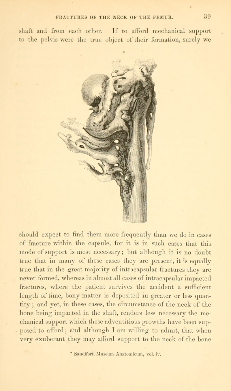 shaft and from each other. If to afford mechanical support to the pelvis were the true object of their formation, surely we should expect to find them more frequently than we do in cases of fracture within the capsule, for it is in such cases that this mode of support is most necessary; but although it is no doubt true that in many of these cases they are present, it is equally true that in the great majority of intracapsular fractures they are never formed, whereas in almost all cases of intracapsular impacted fractures, where the patient survives the accident a sufficient length of time, bony matter is deposited in greater or less quan- tity ; and yet, in these cases, the circumstance of the neck of the bone being impacted in the shaft, renders less necessary the me- chanical support which these adventitious growths have been sup- posed to afford; and although I am willing to admit, that when very exuberant they may afford support to the neck of the bone Sandifort, Museum Anatomicum, vol. iv.