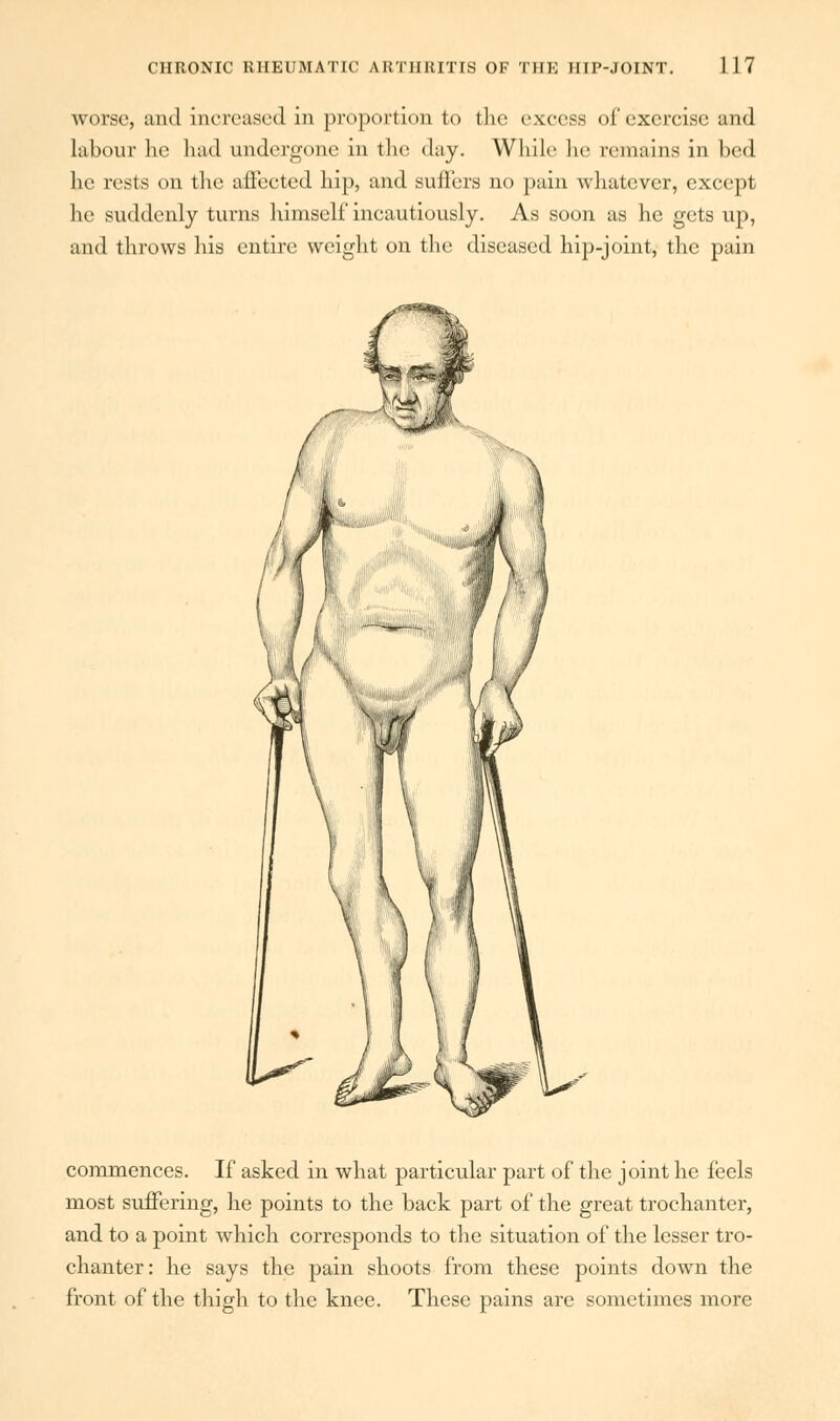 worse, and increased in proportion to the excess of exorcise and labour he had undergone in the day. While he remains in bed he tests on the affected hip, and suffers no pain whatever, except he suddenly turns himself incautiously. As soon as he gets up, and throws his entire weight on the diseased hip-joint, the pain commences. If asked in what particular part of the joint he feels most suffering, he points to the back part of the great trochanter, and to a point which corresponds to the situation of the lesser tro- chanter: he says the pain shoots from these points down the front of the thigh to the knee. These pains are sometimes more